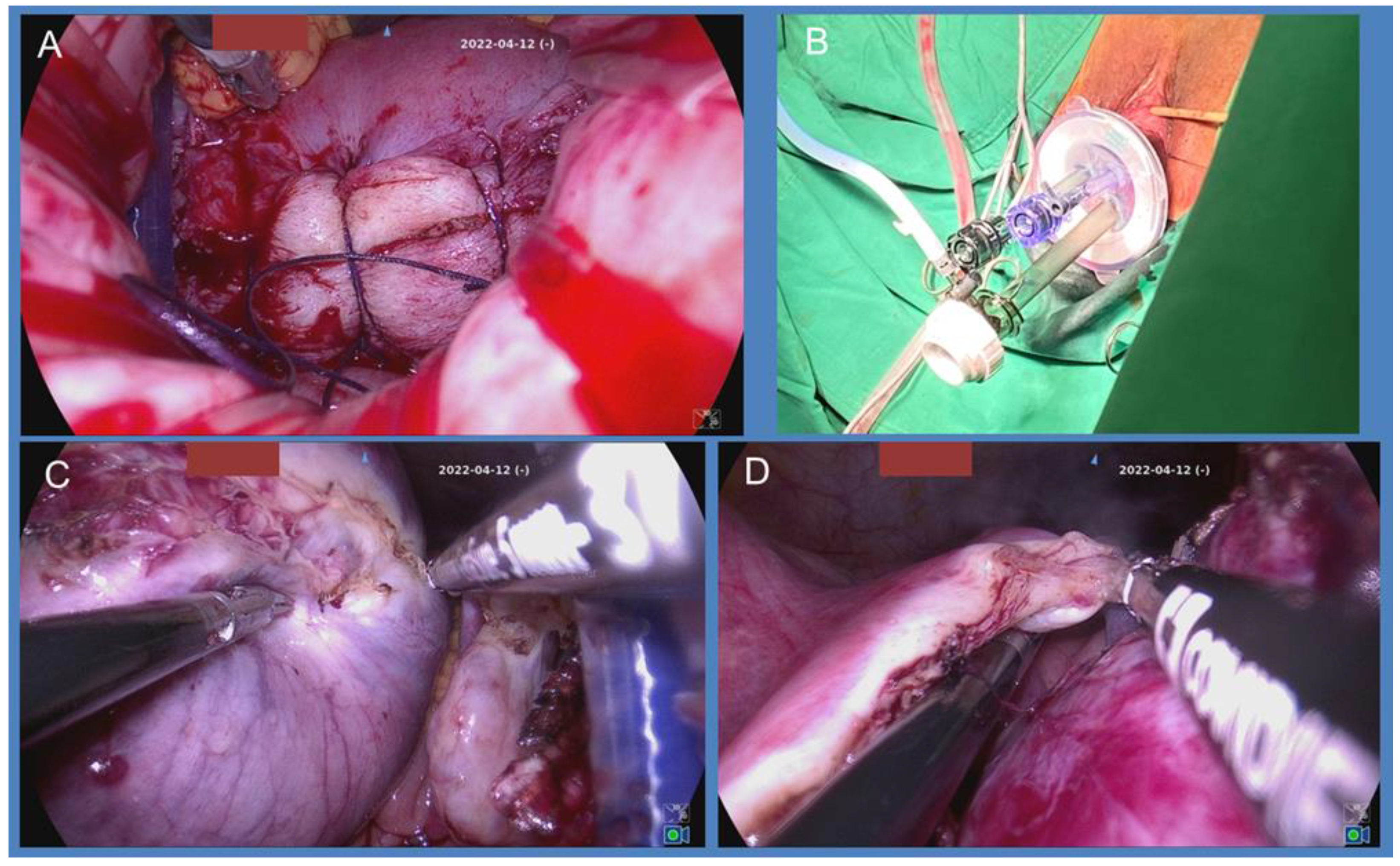 Preprints 175362 g001
