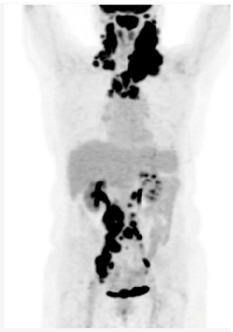 Preprints 147218 i001