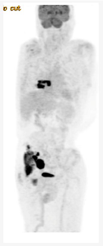 Preprints 147218 i004