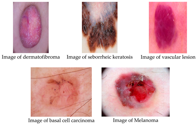 Preprints 161859 i001