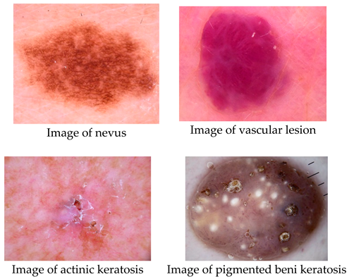 Preprints 161859 i002