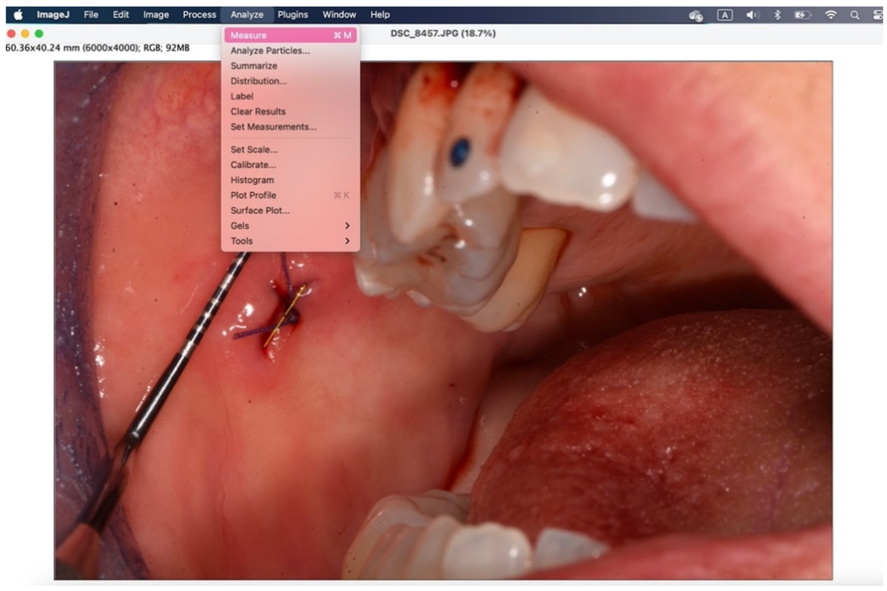 Preprints 145132 g011