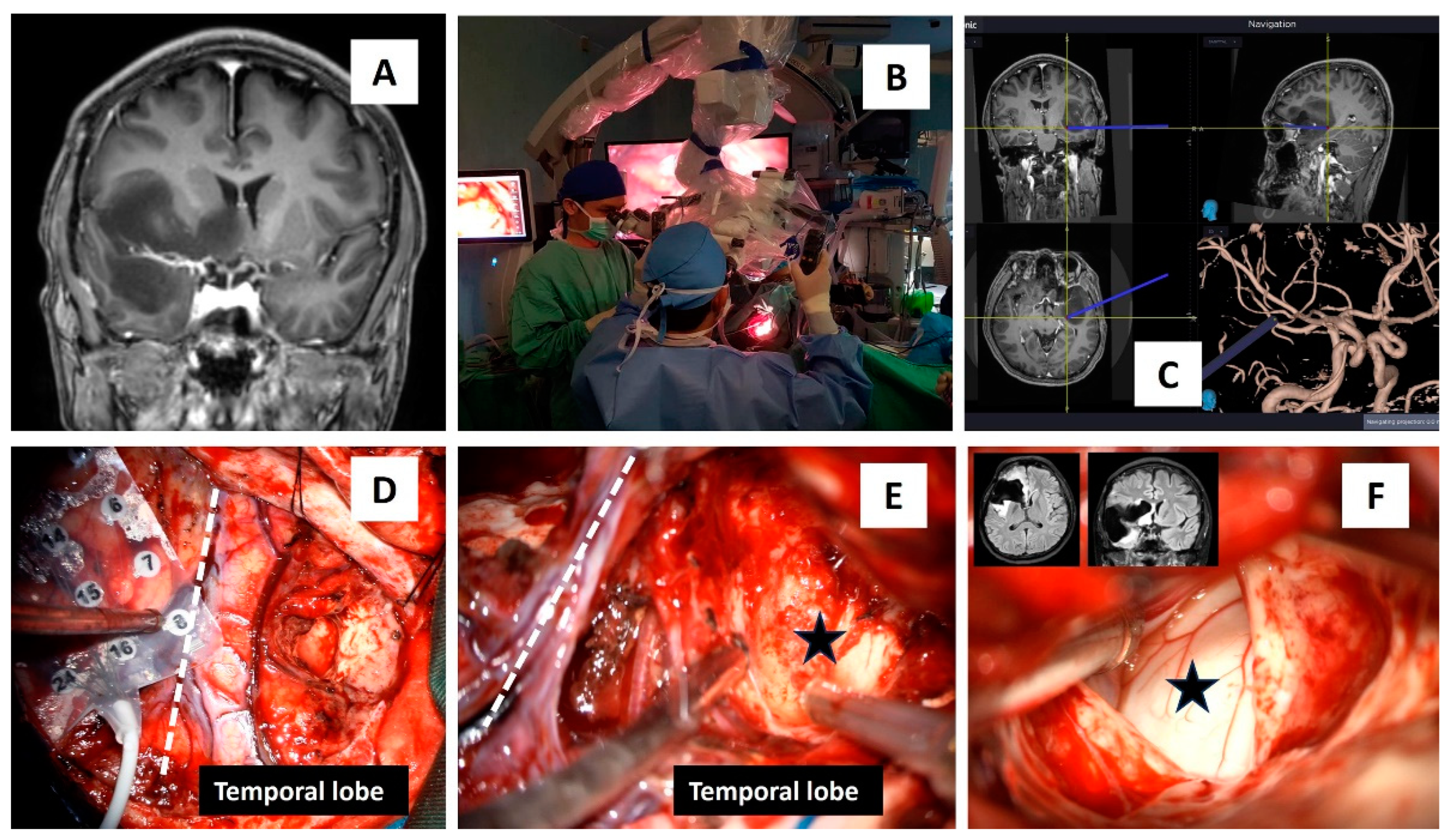 Light and Brain: A Clinical Case Depicting the Effects of Light on