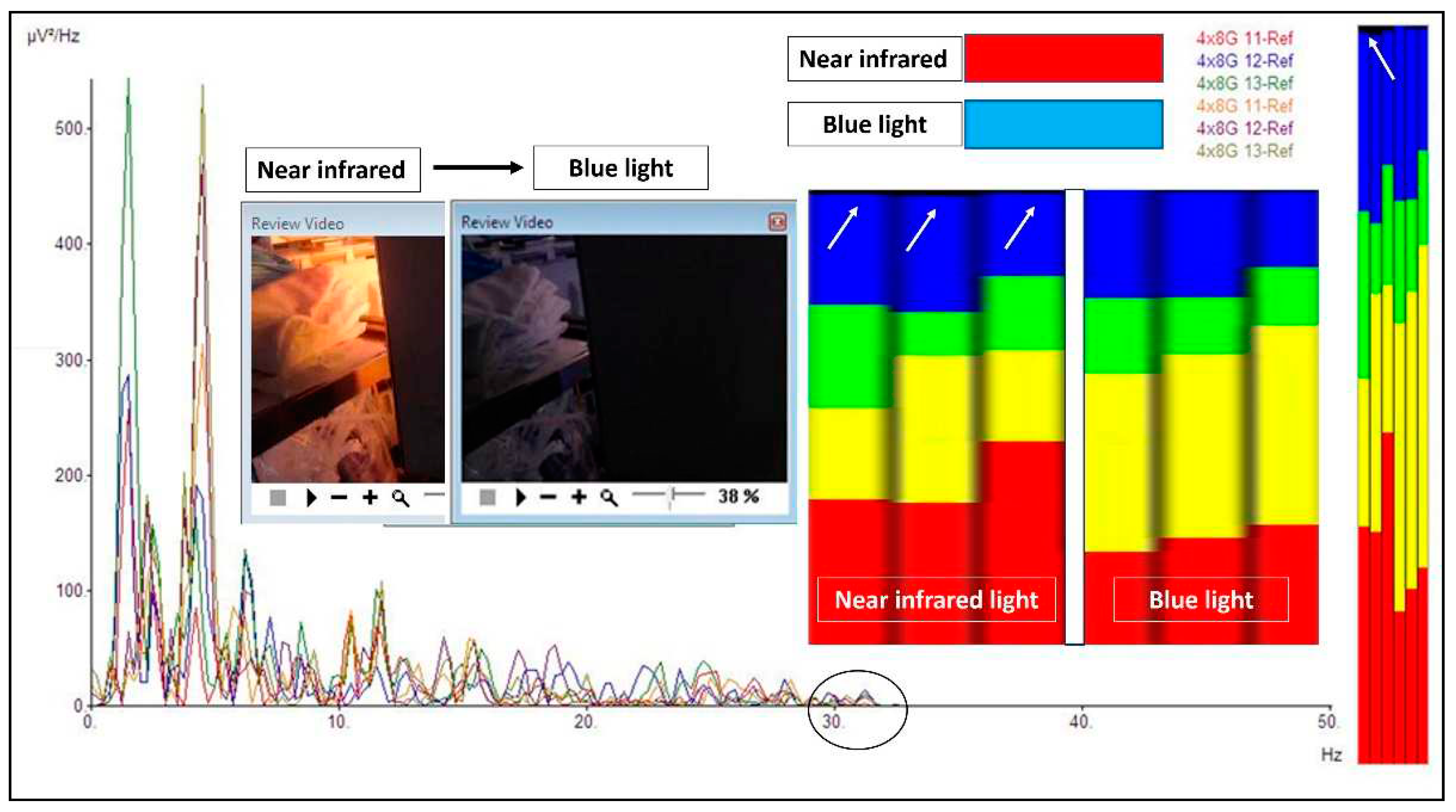 Light and Brain: A Clinical Case Depicting the Effects of Light on