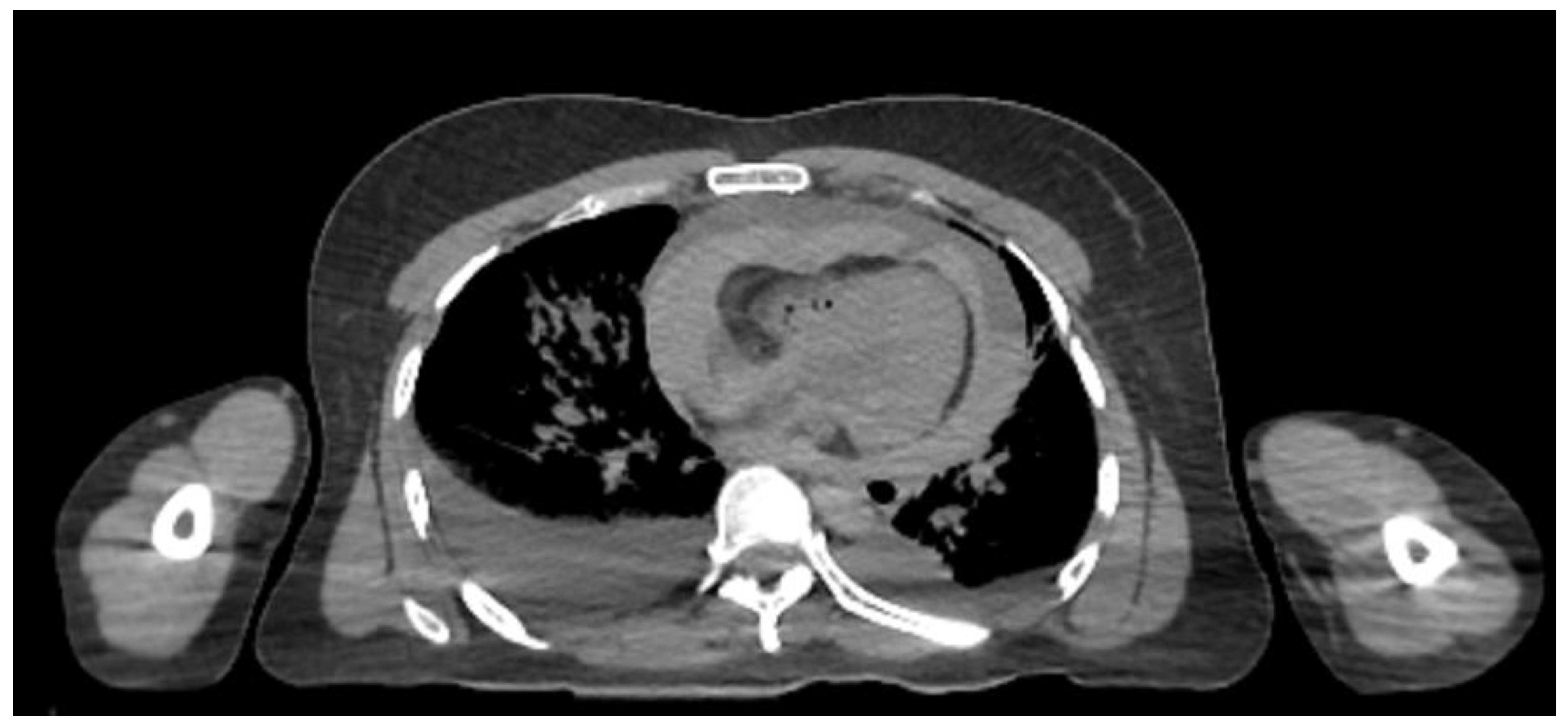 Preprints 69391 g003