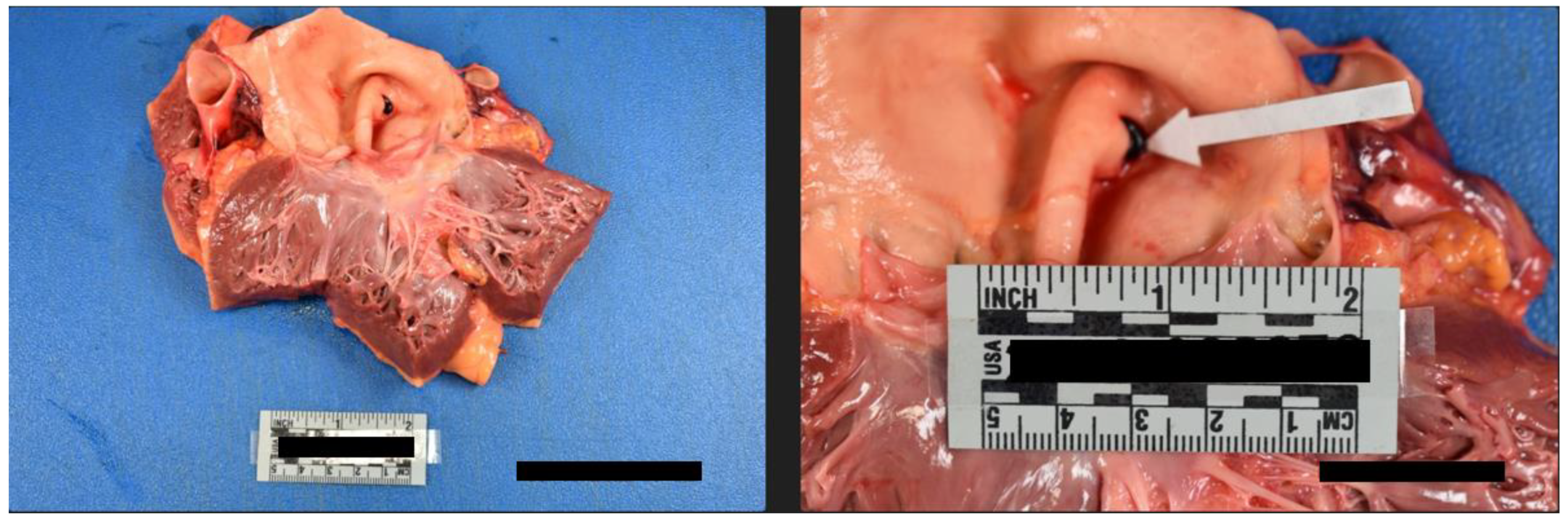 Preprints 69391 g004