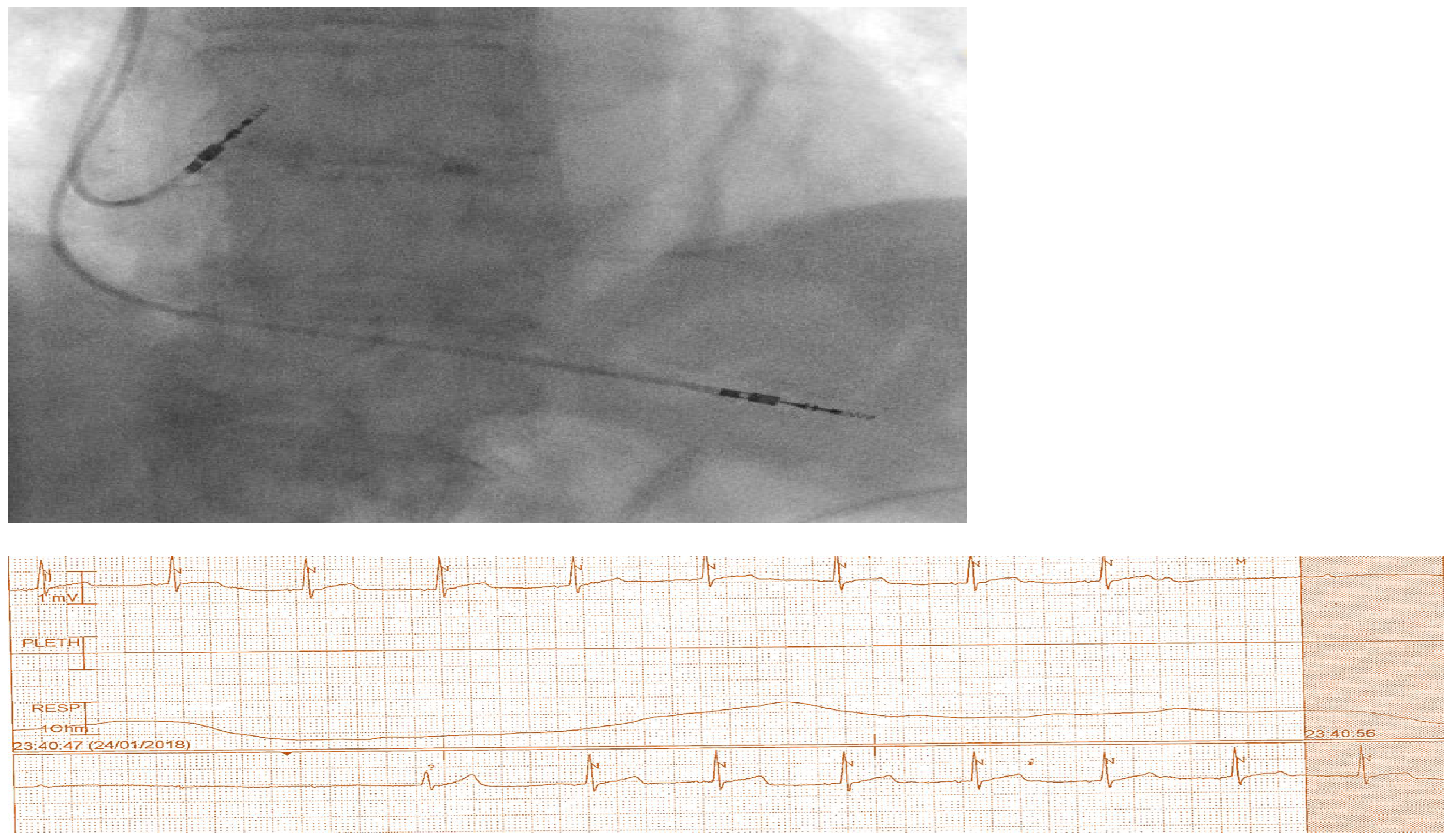Preprints 119732 g002b