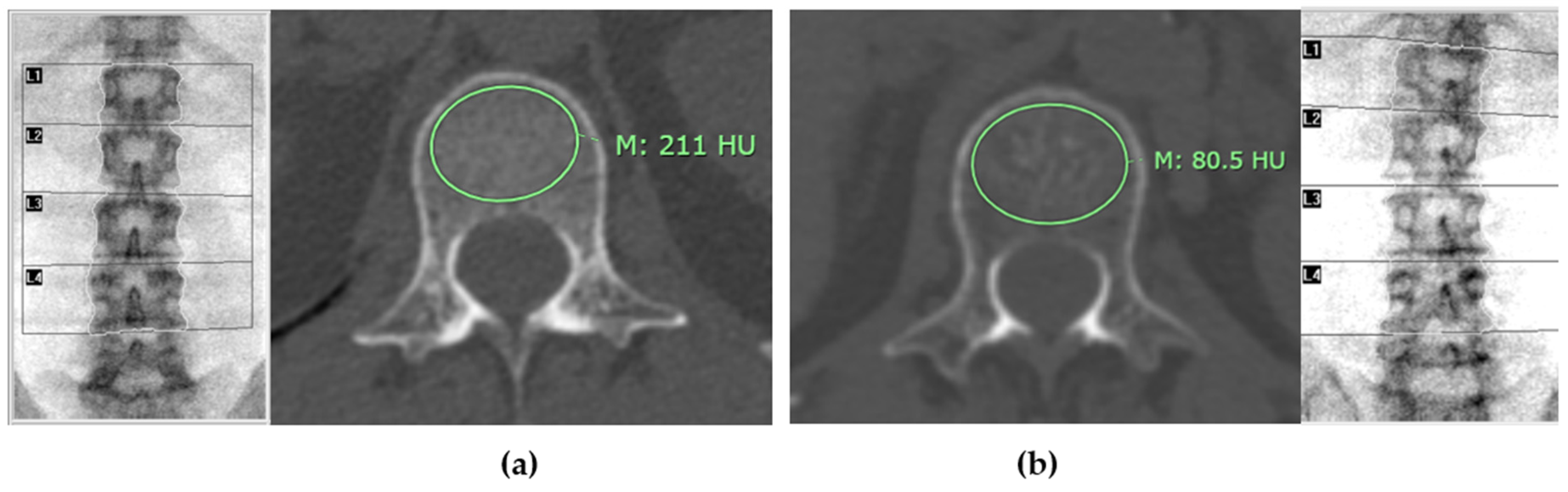 Preprints 140114 g004