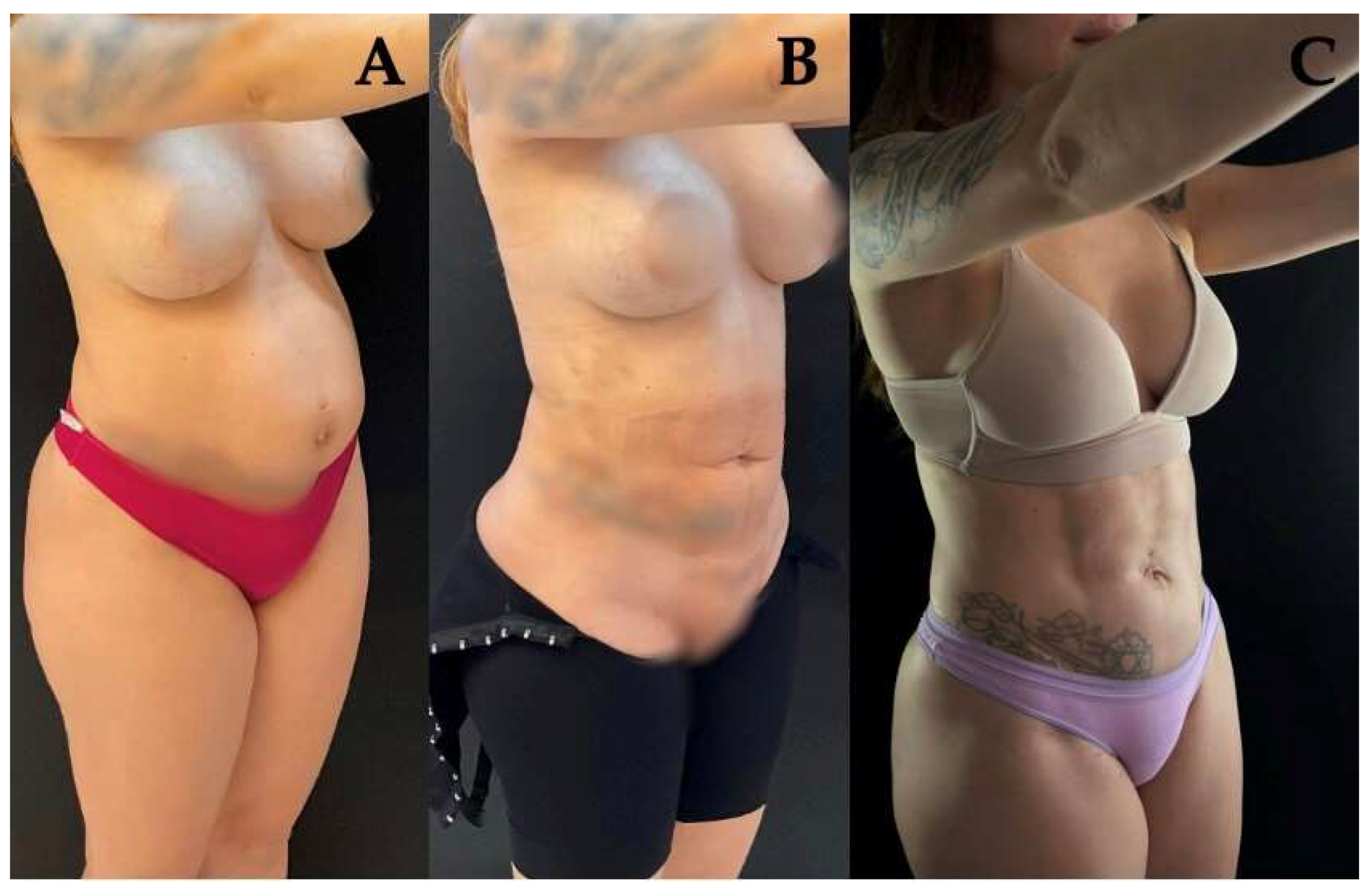 Preprints 159652 g002