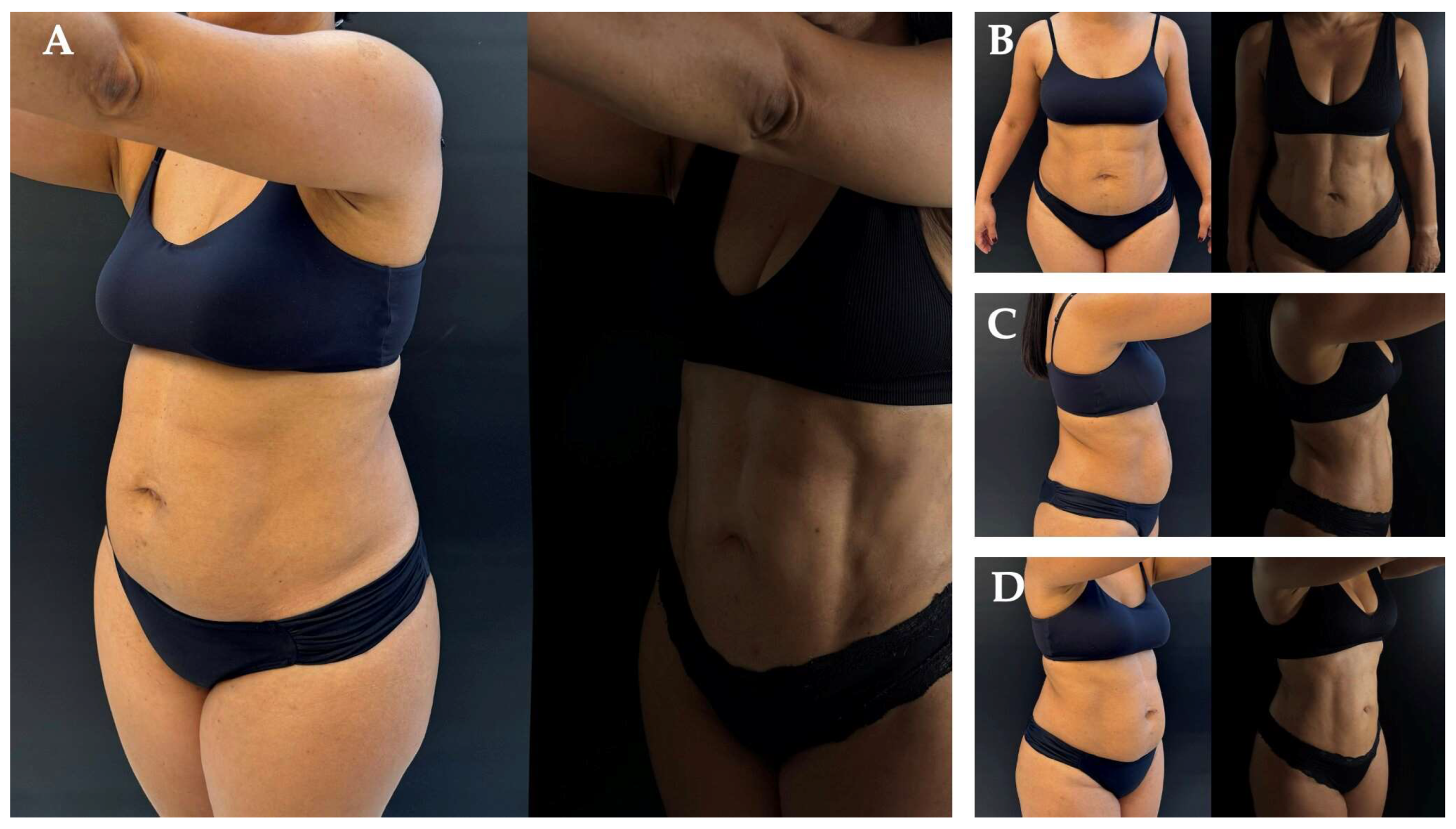 Preprints 159652 g004