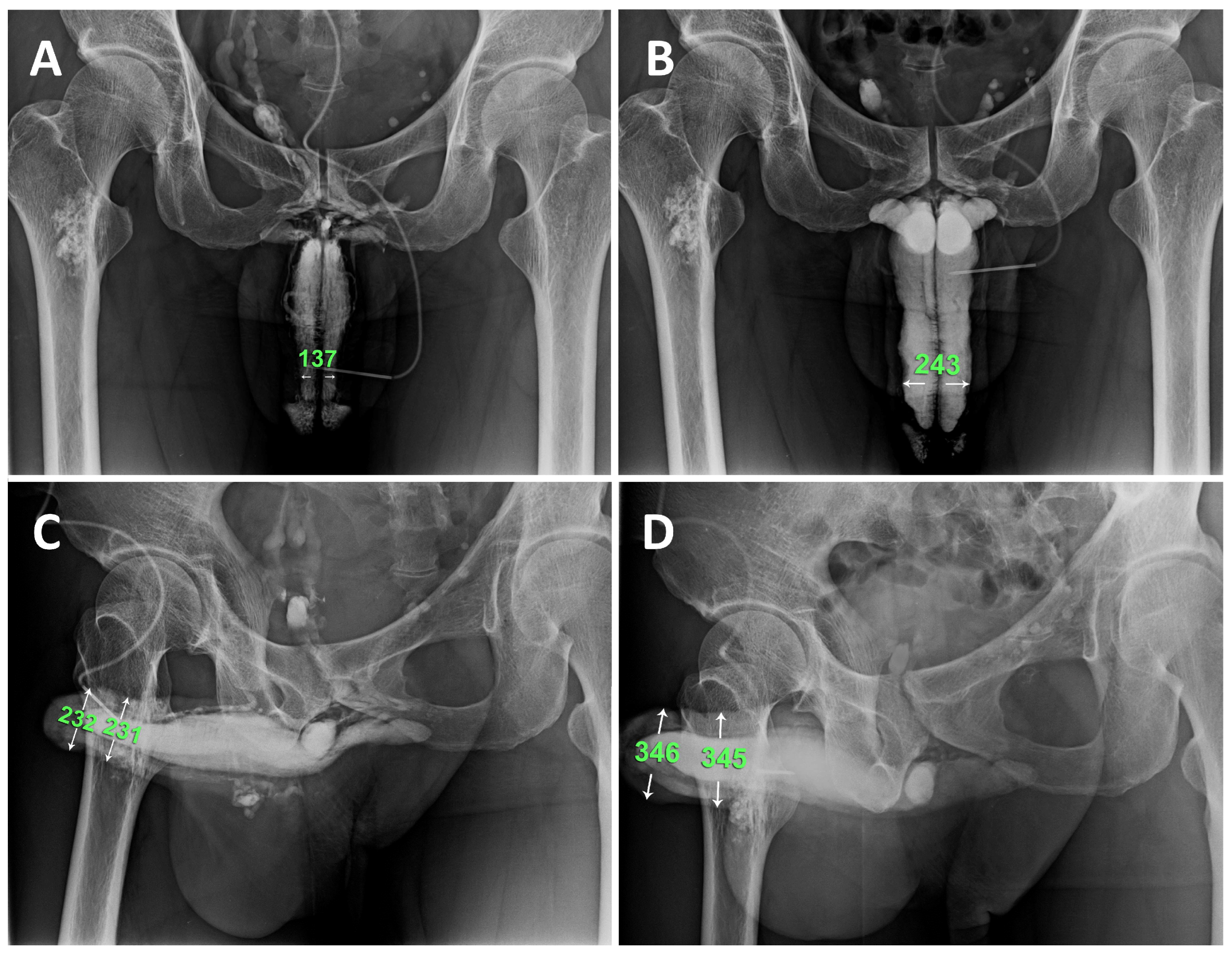 Preprints 109698 g005