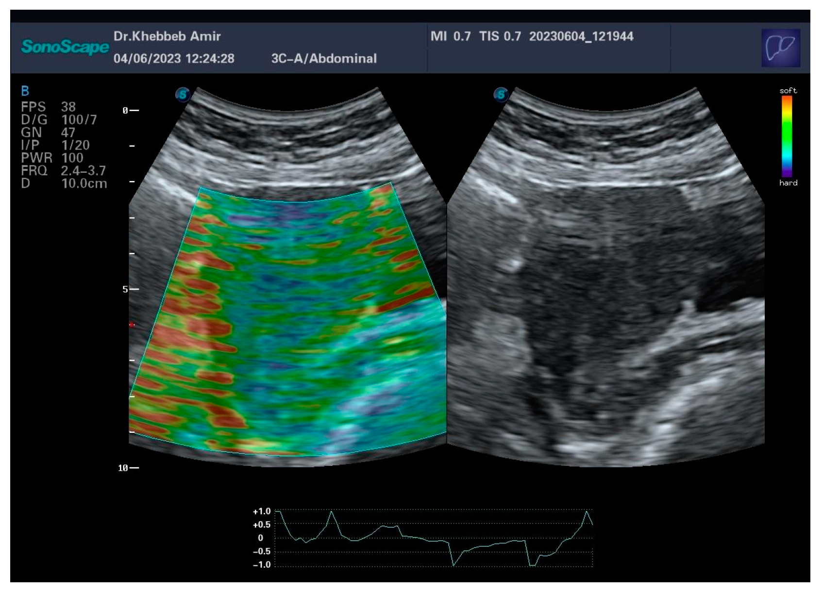 Preprints 146226 g004