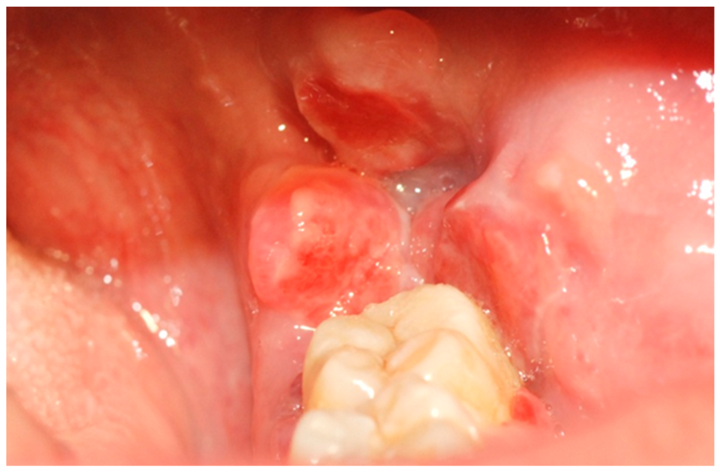 Preprints 151864 g001