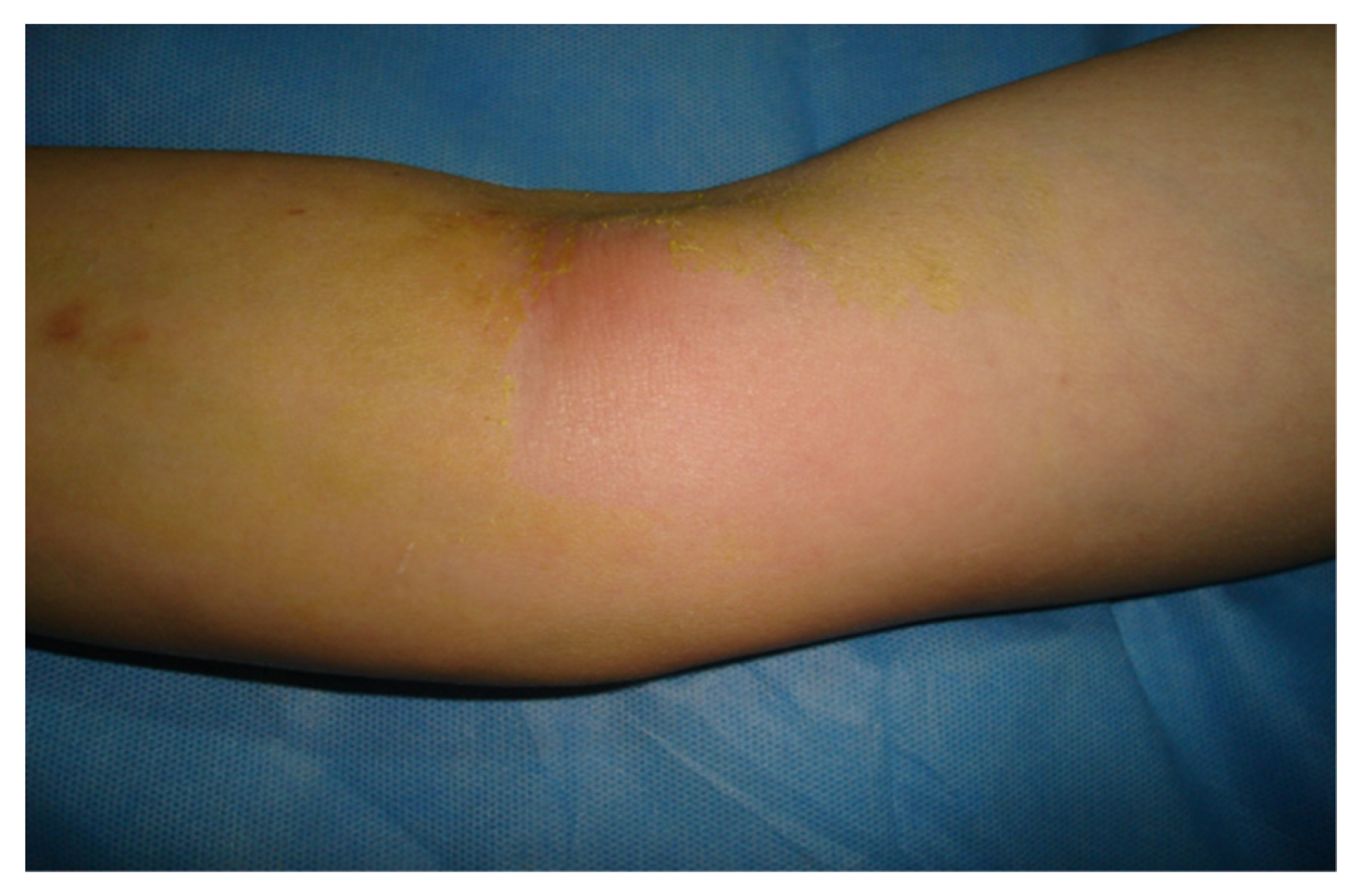 Preprints 154387 g001