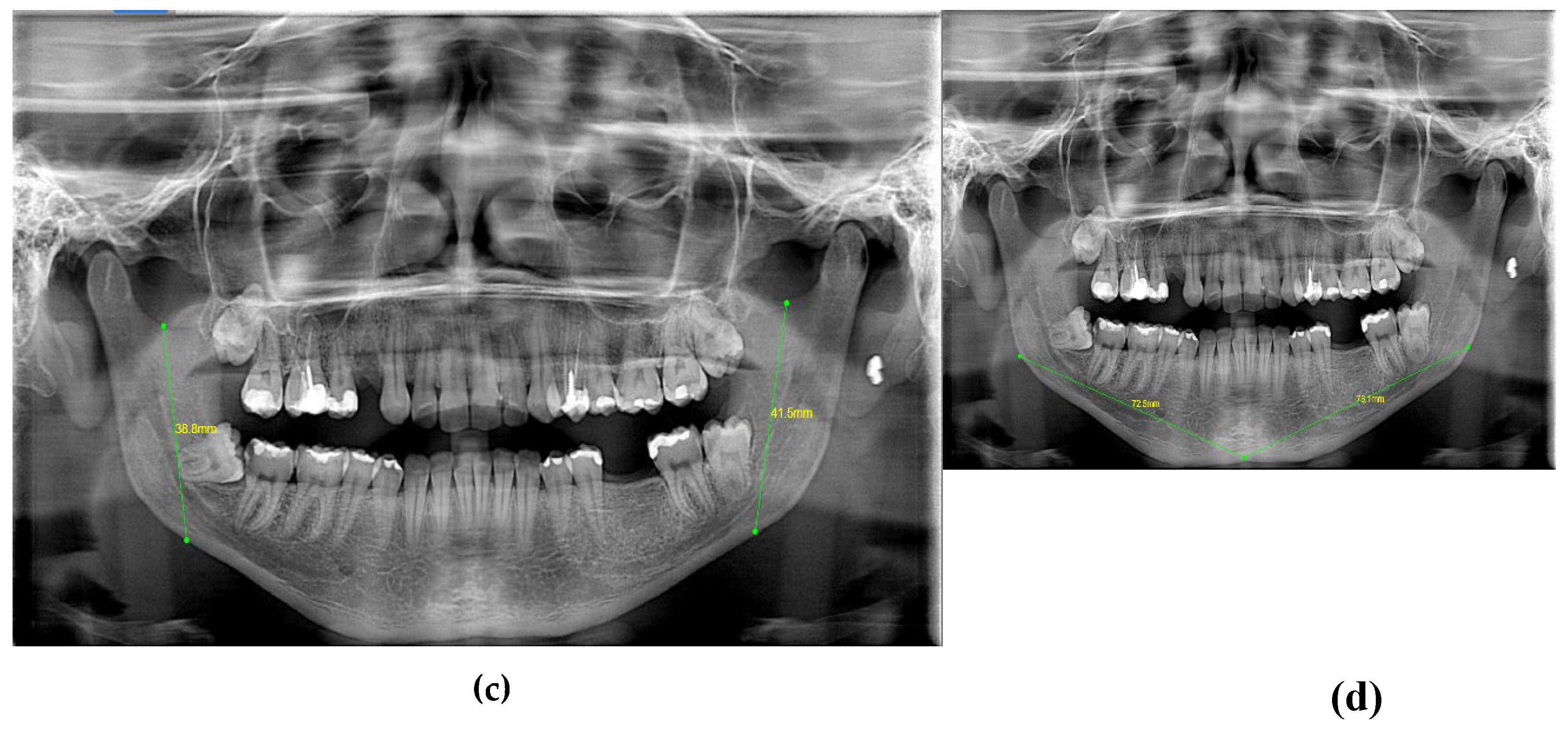 Preprints 146687 g004b