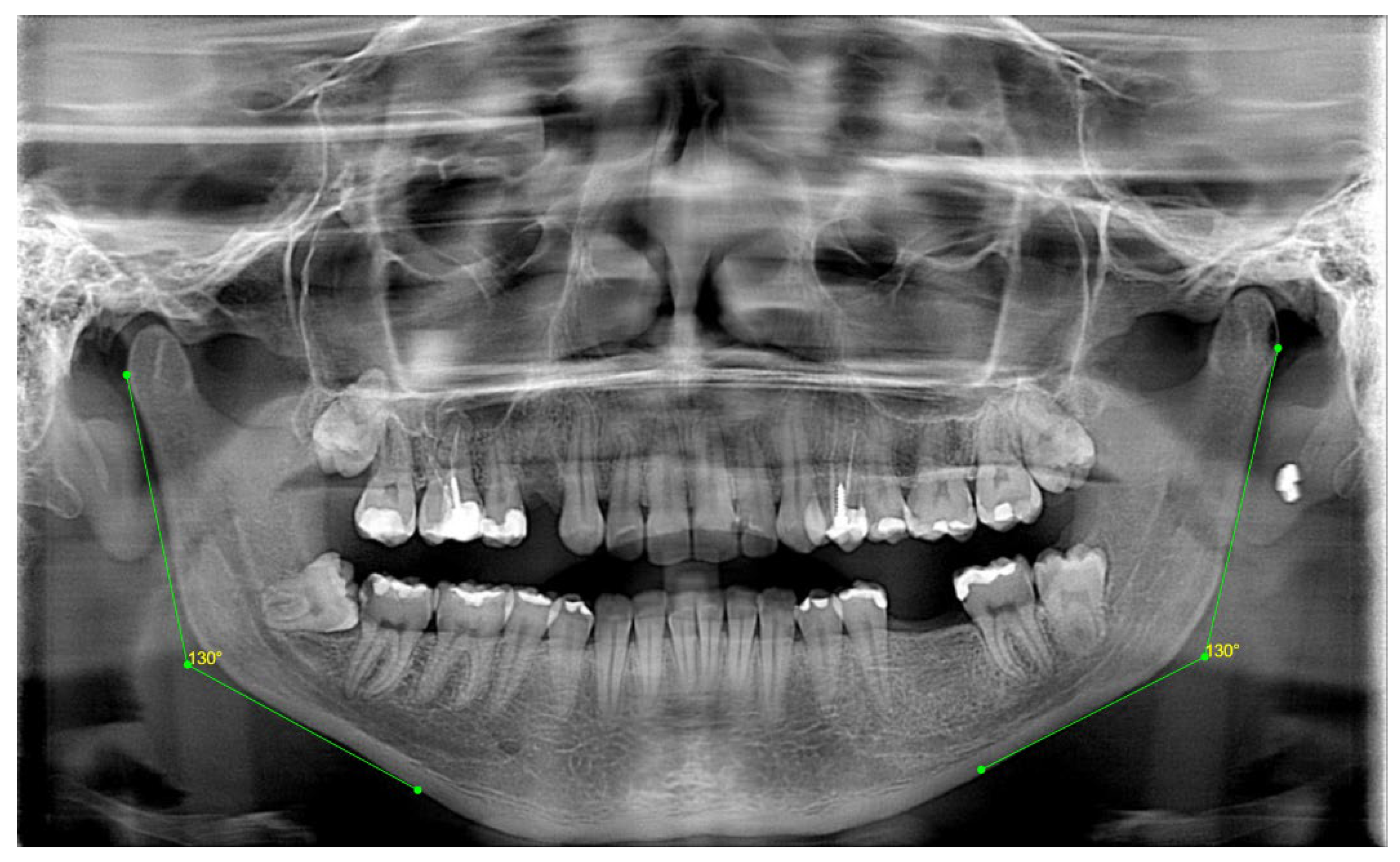 Preprints 146687 g005