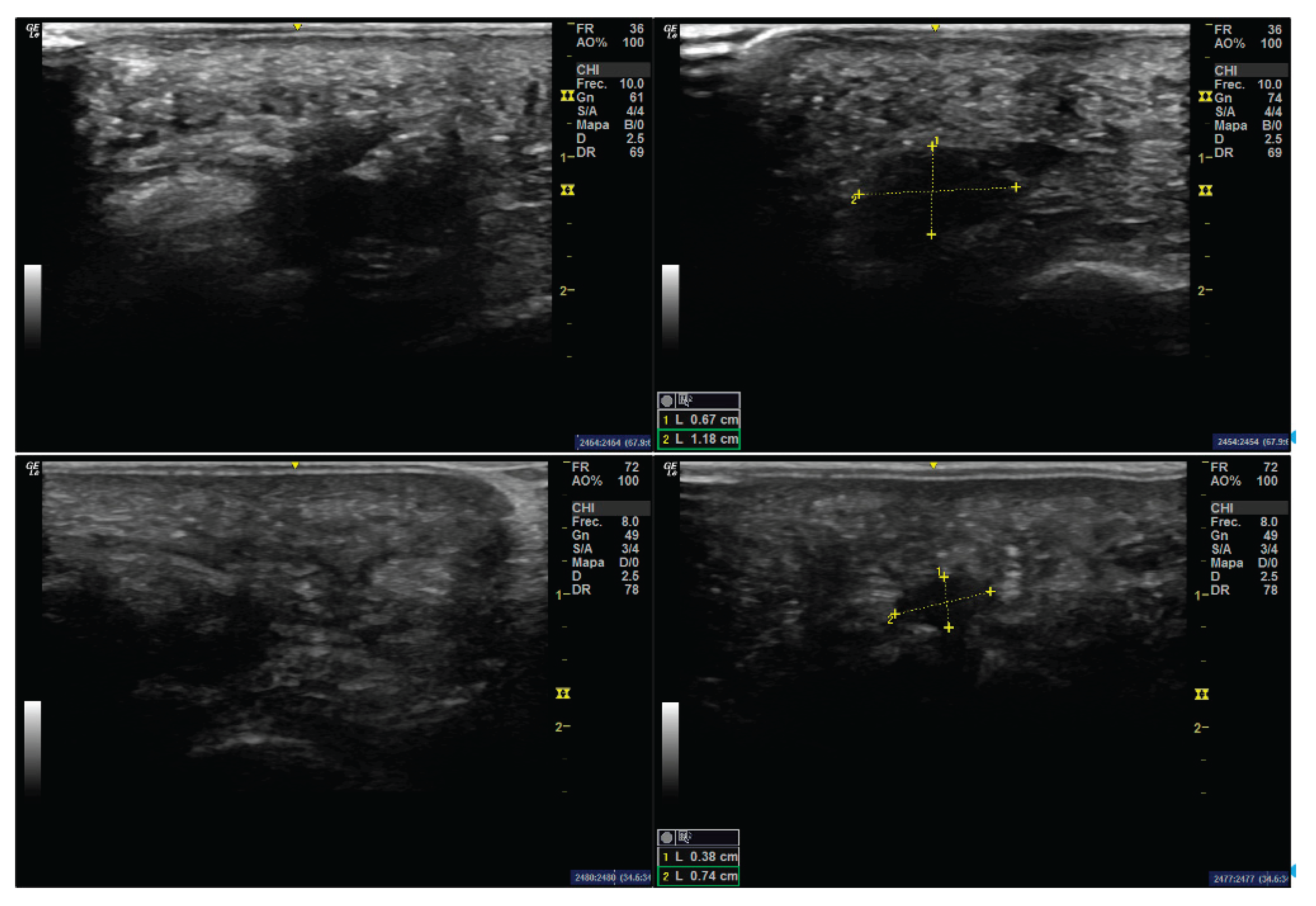 Preprints 161383 g001