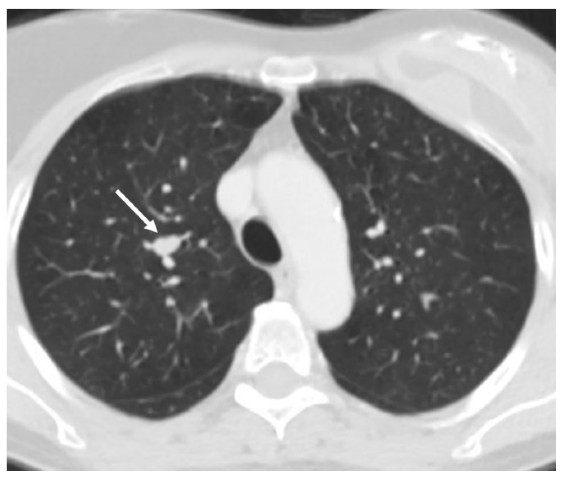 Preprints 167694 g001
