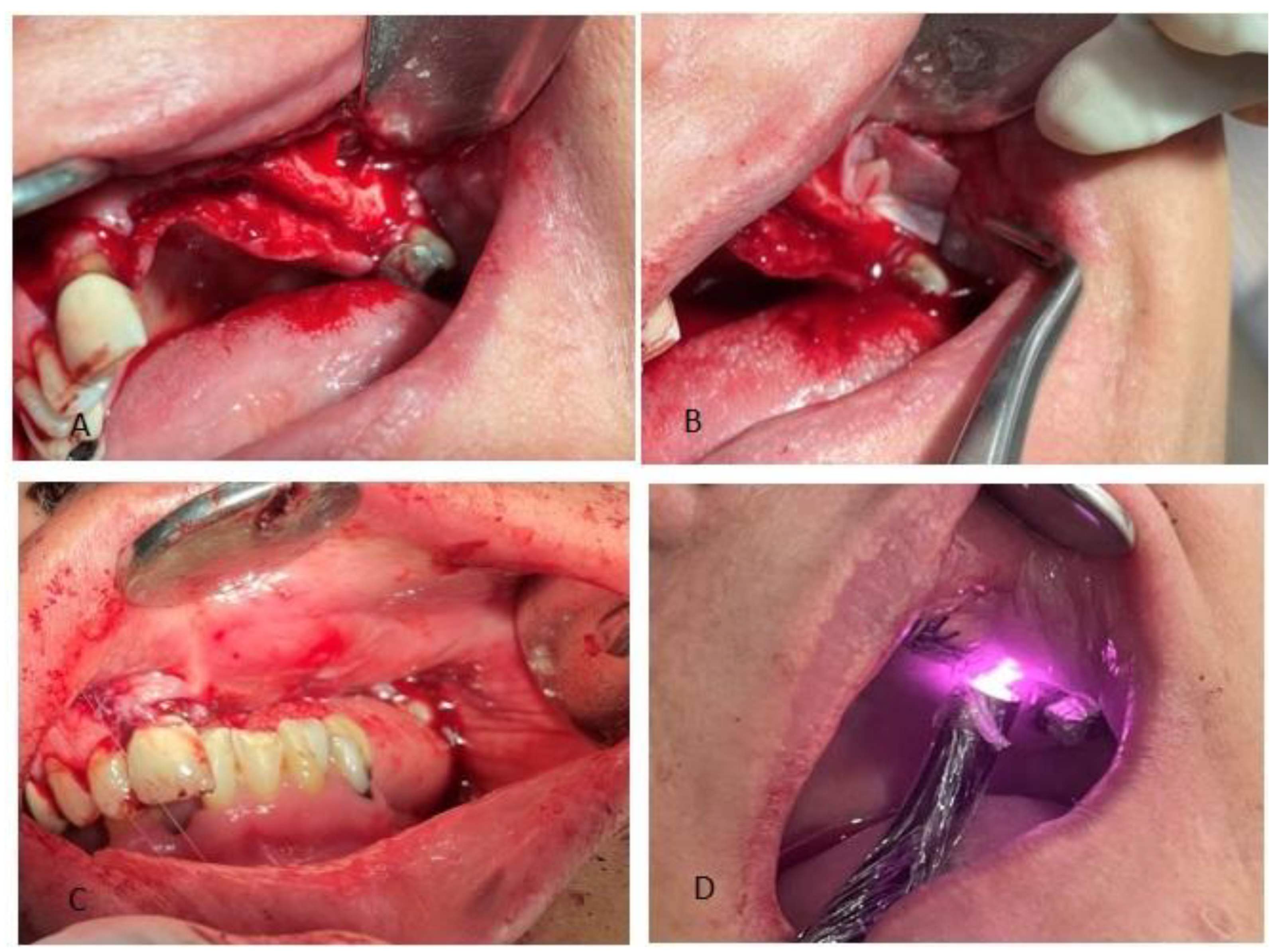 Preprints 172730 g005