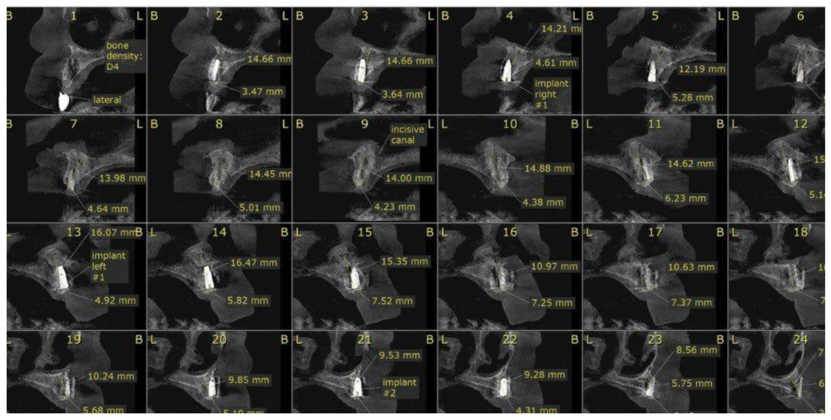 Preprints 172730 g008