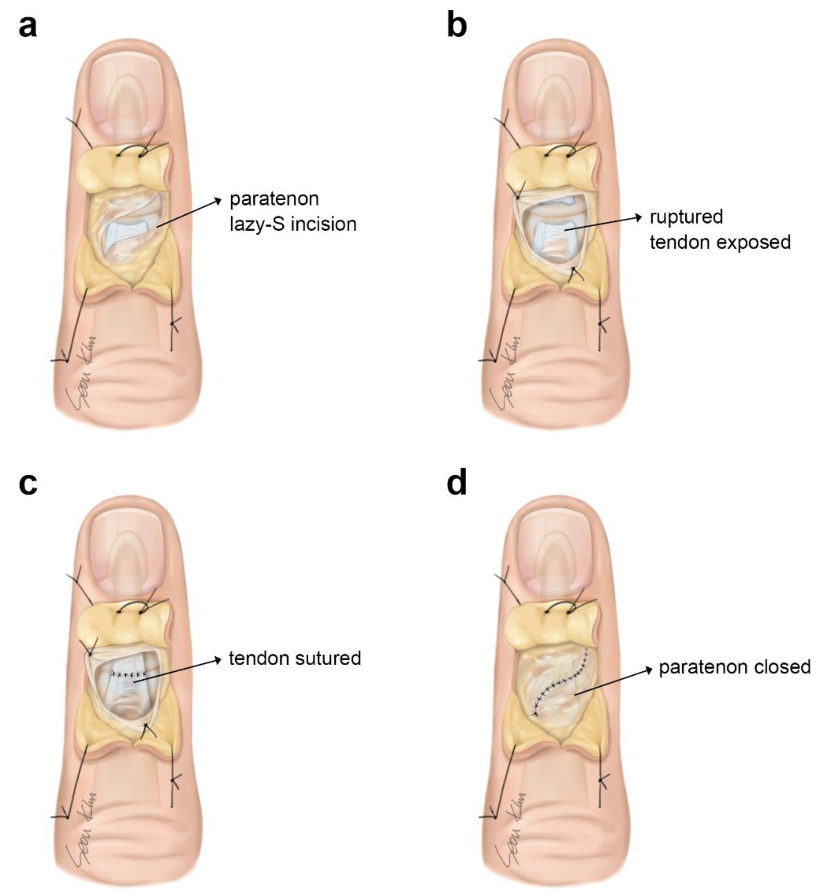 Preprints 104248 g001