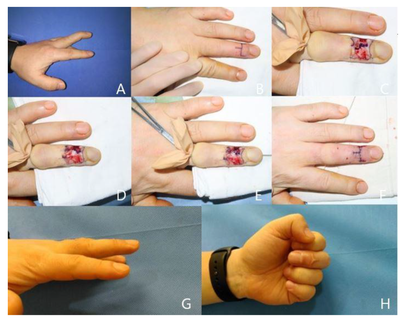 Preprints 104248 g003