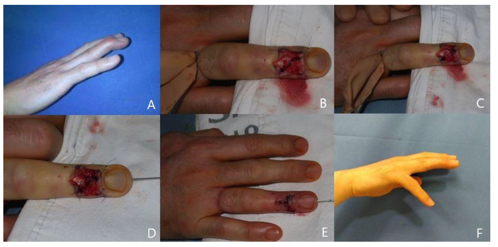 Preprints 104248 g004