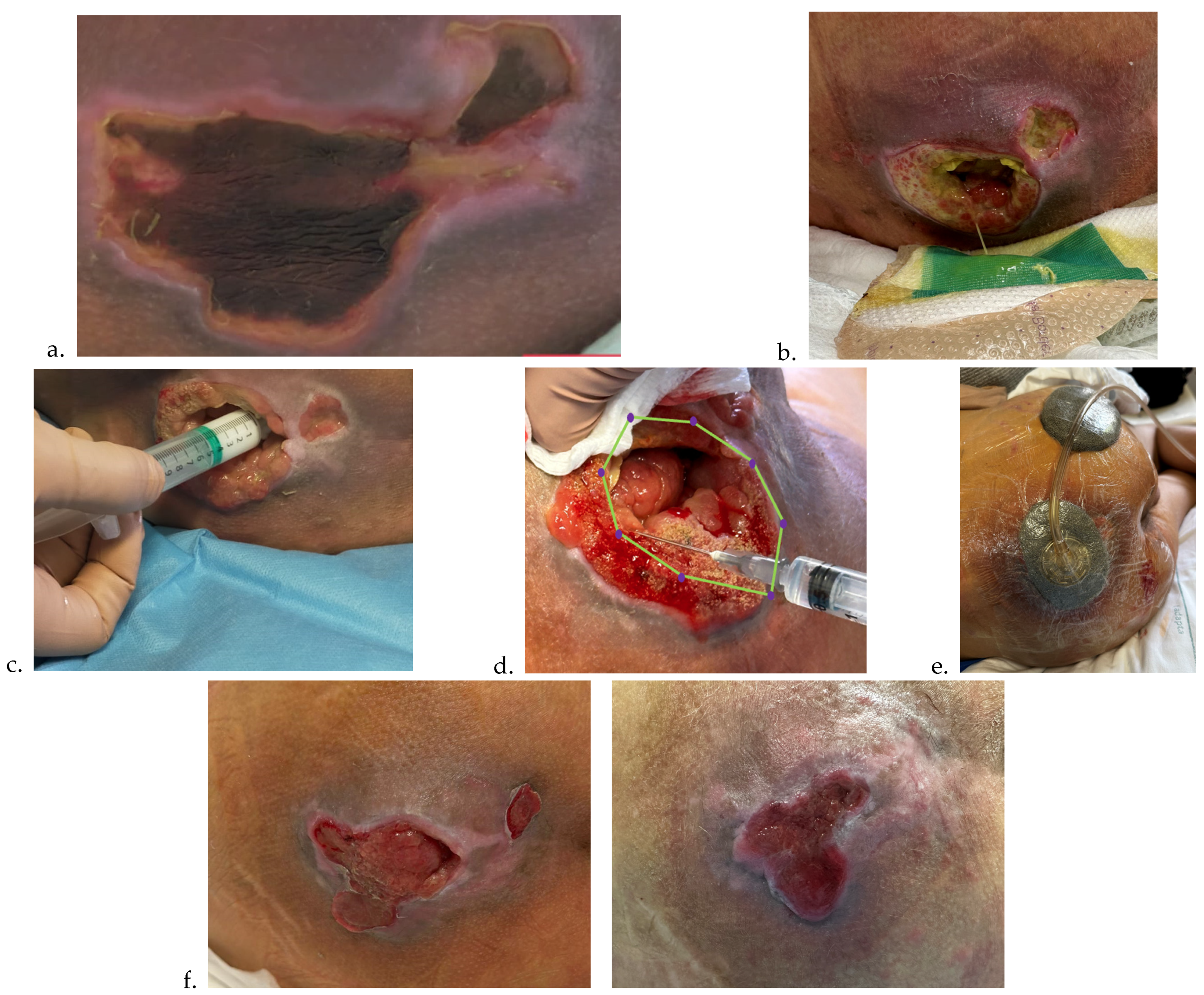 Preprints 178744 g002