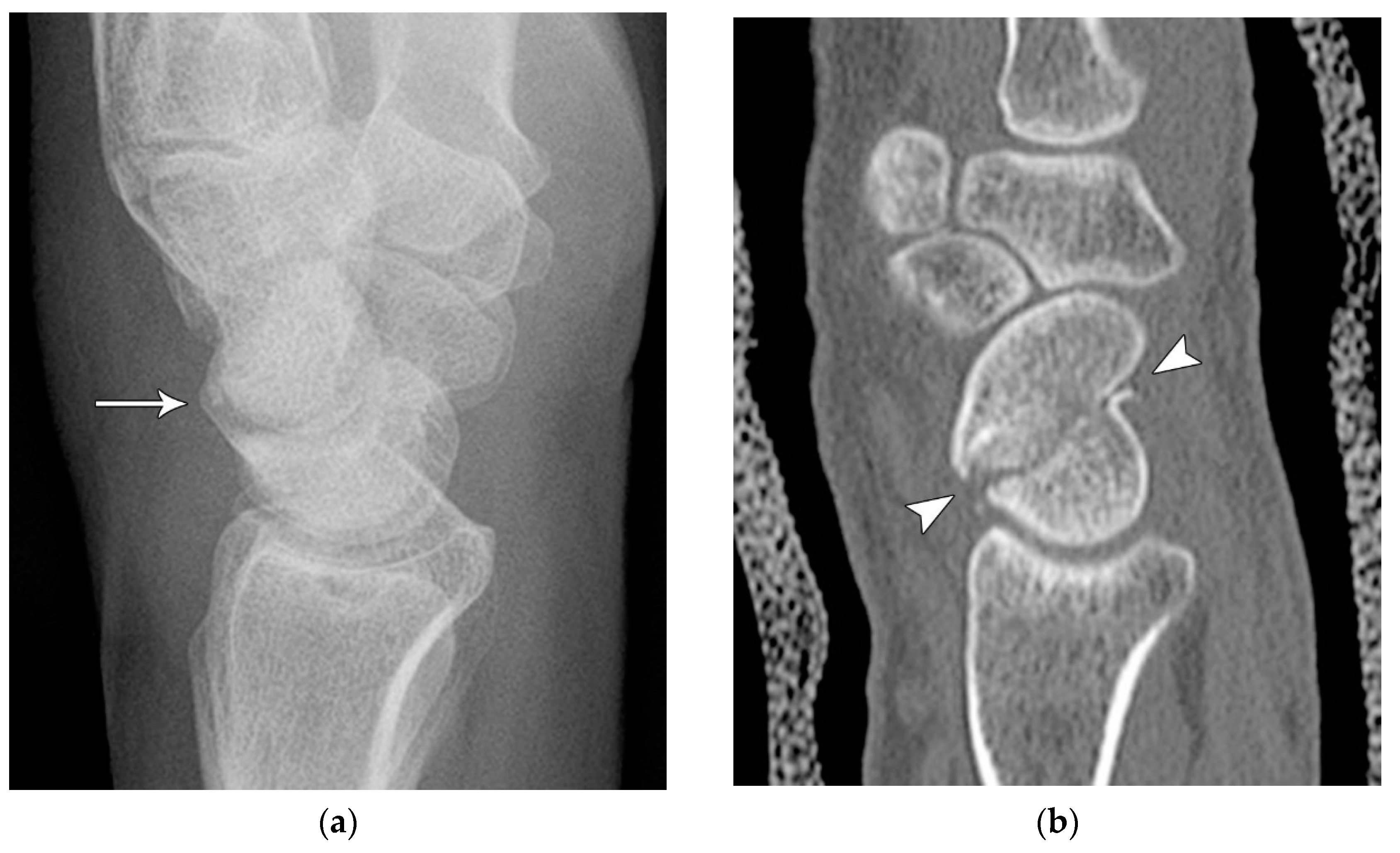 Preprints 72000 g004