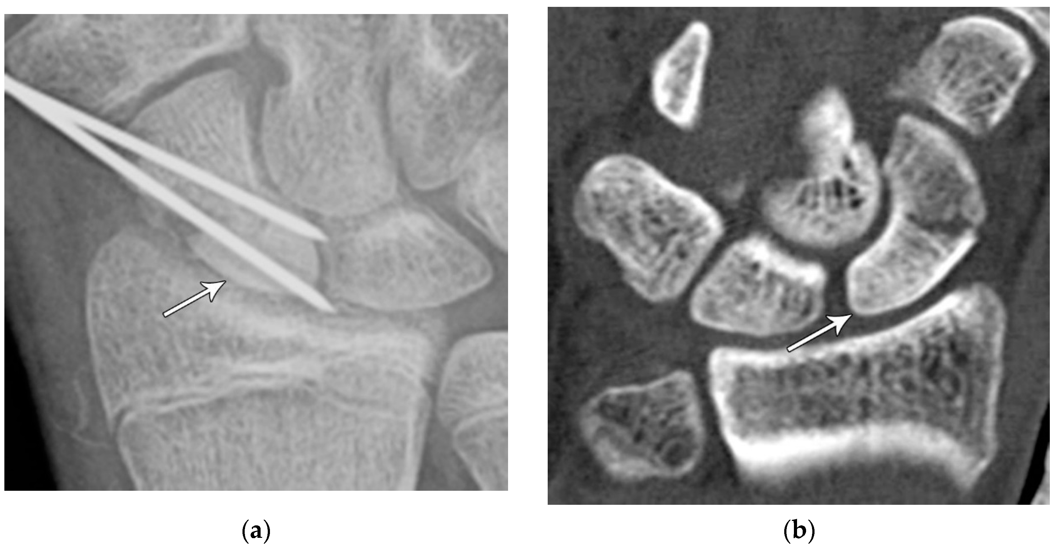 Preprints 72000 g005