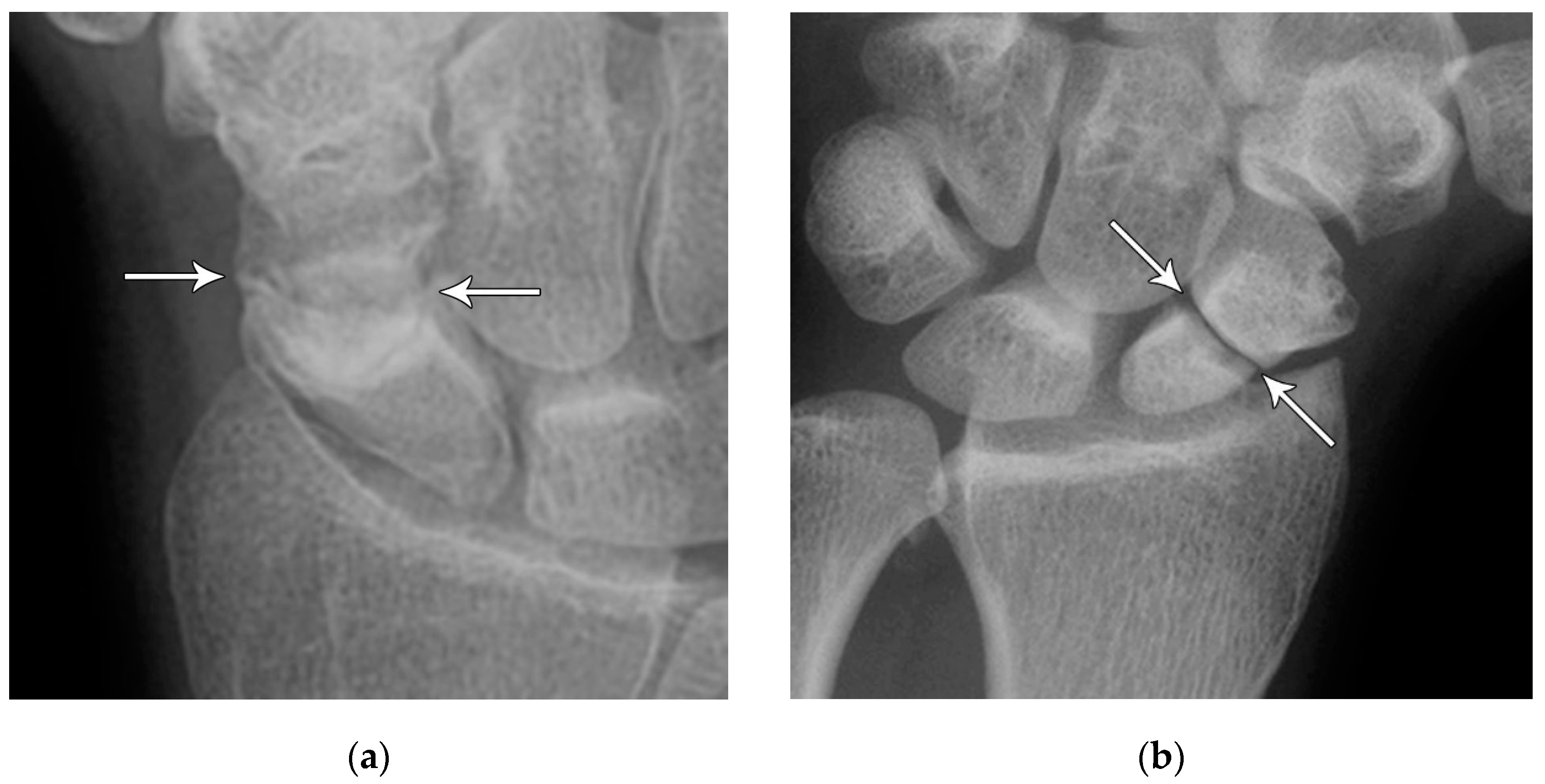 Preprints 72000 g006