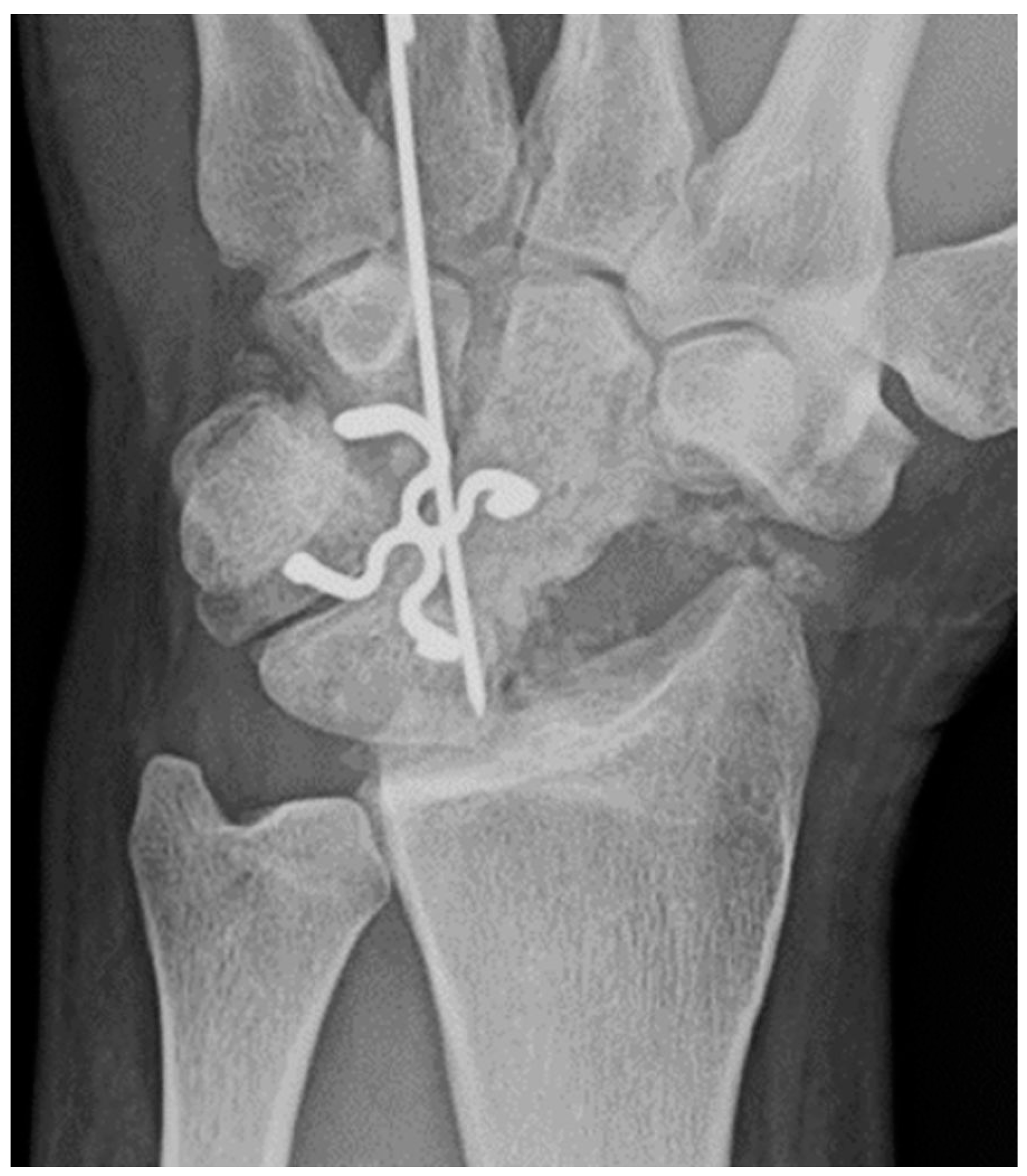 Preprints 72000 g007