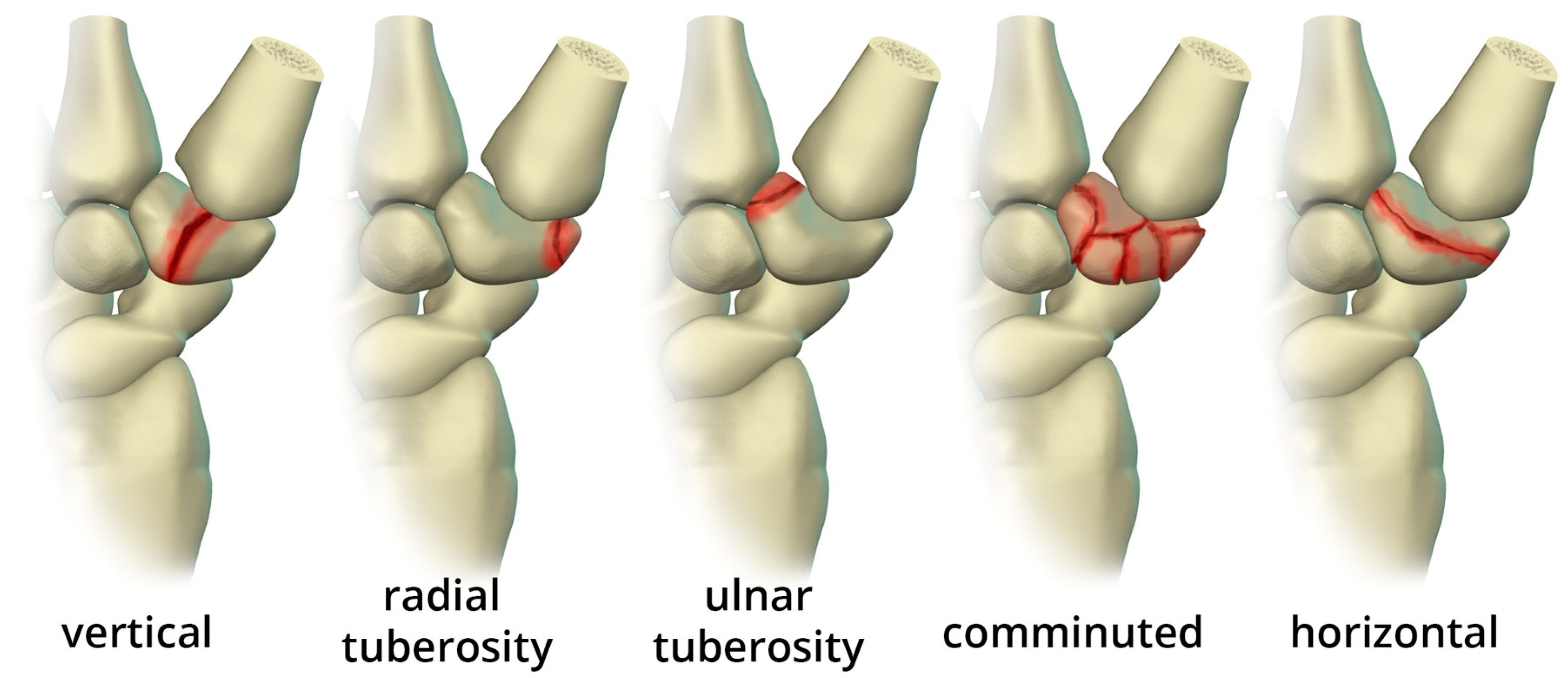 Preprints 72000 g011