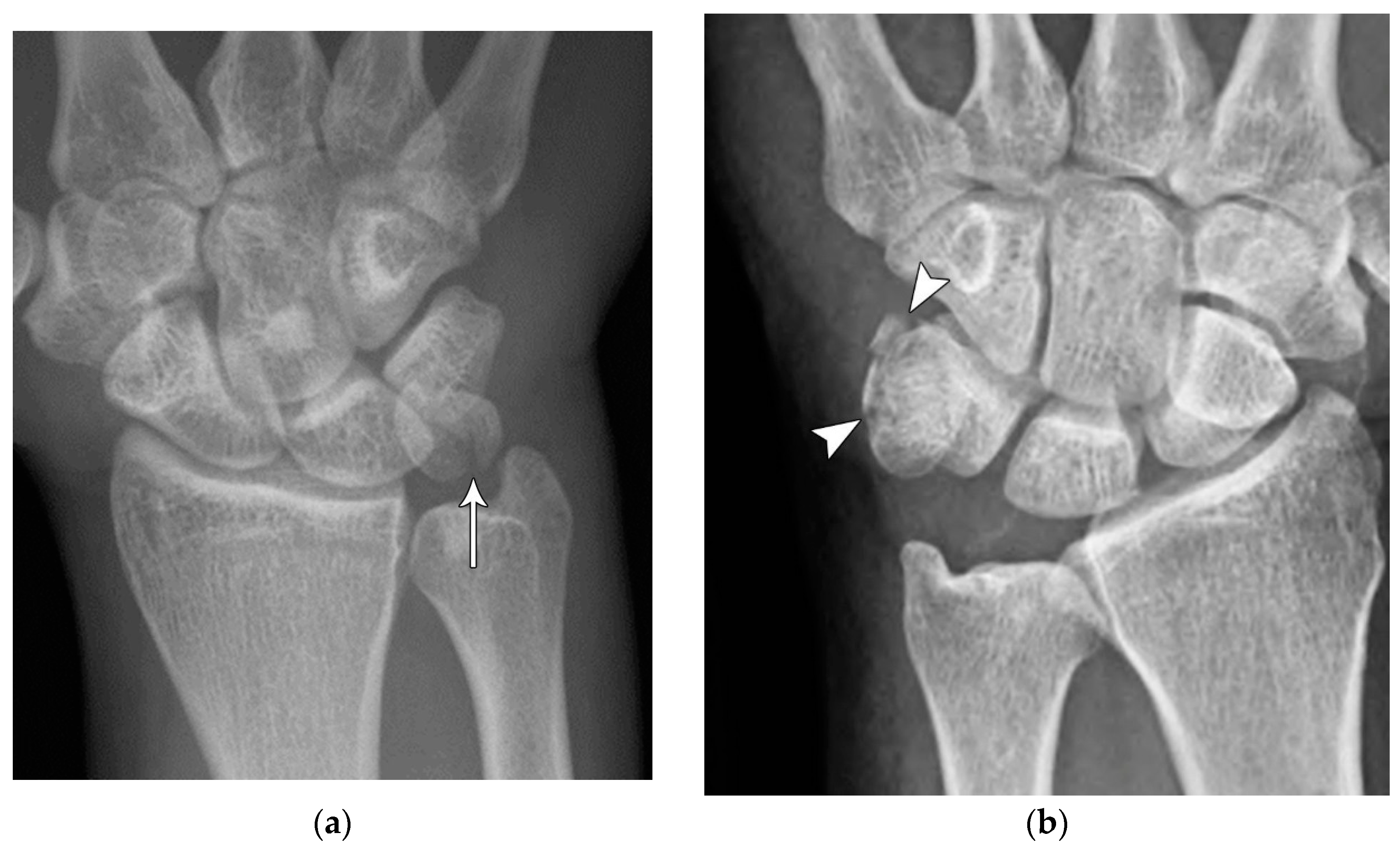 Preprints 72000 g013