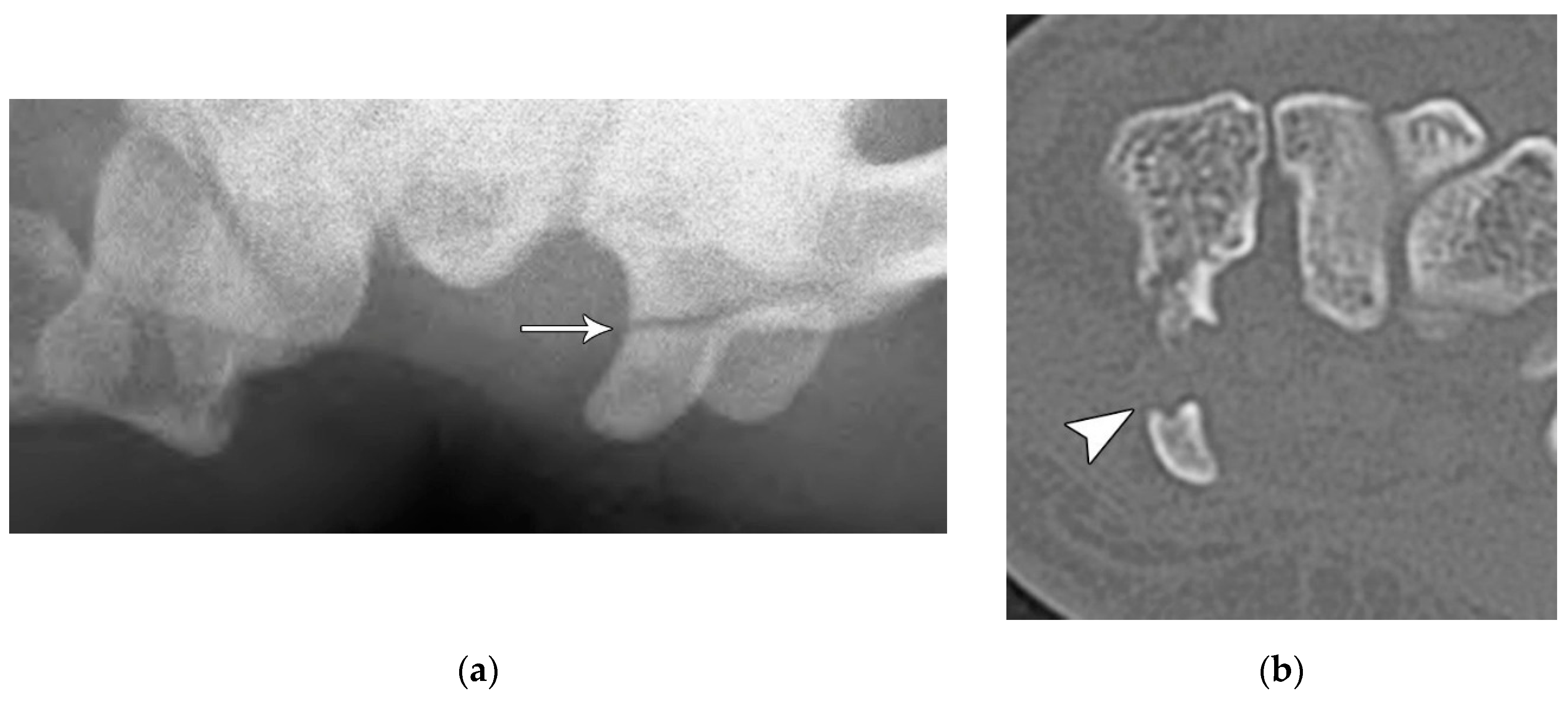 Preprints 72000 g014