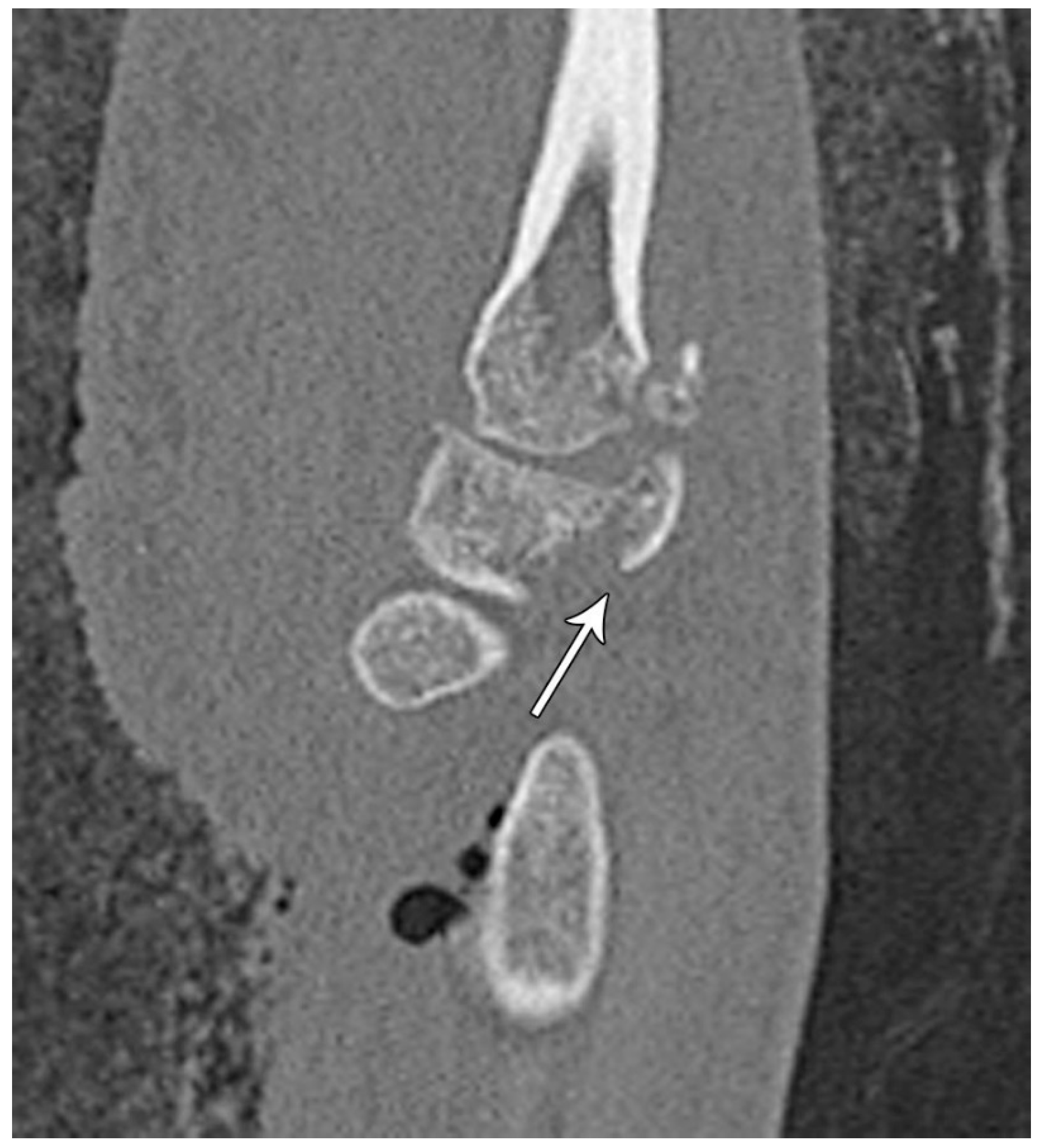 Preprints 72000 g017