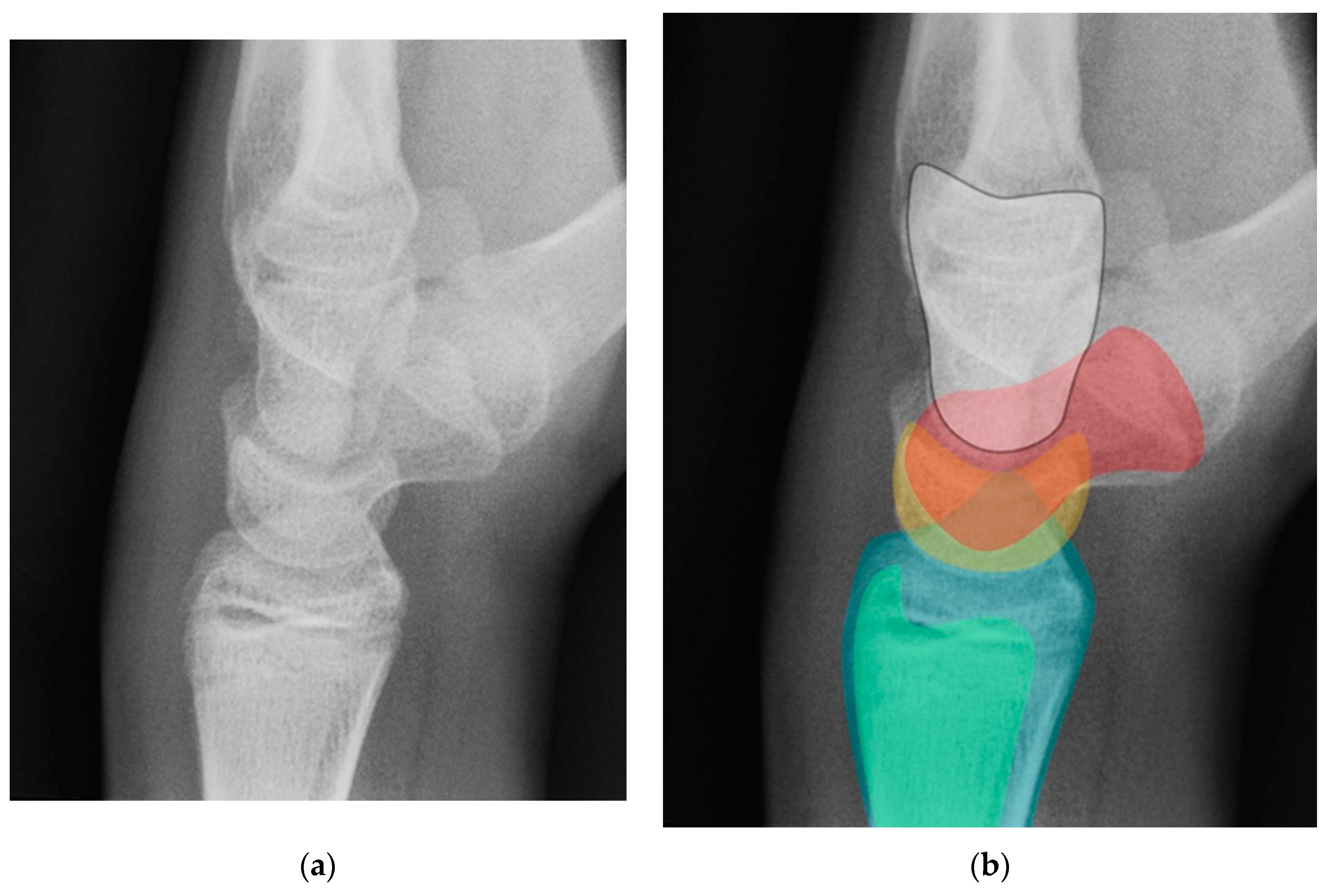 Preprints 72000 g018
