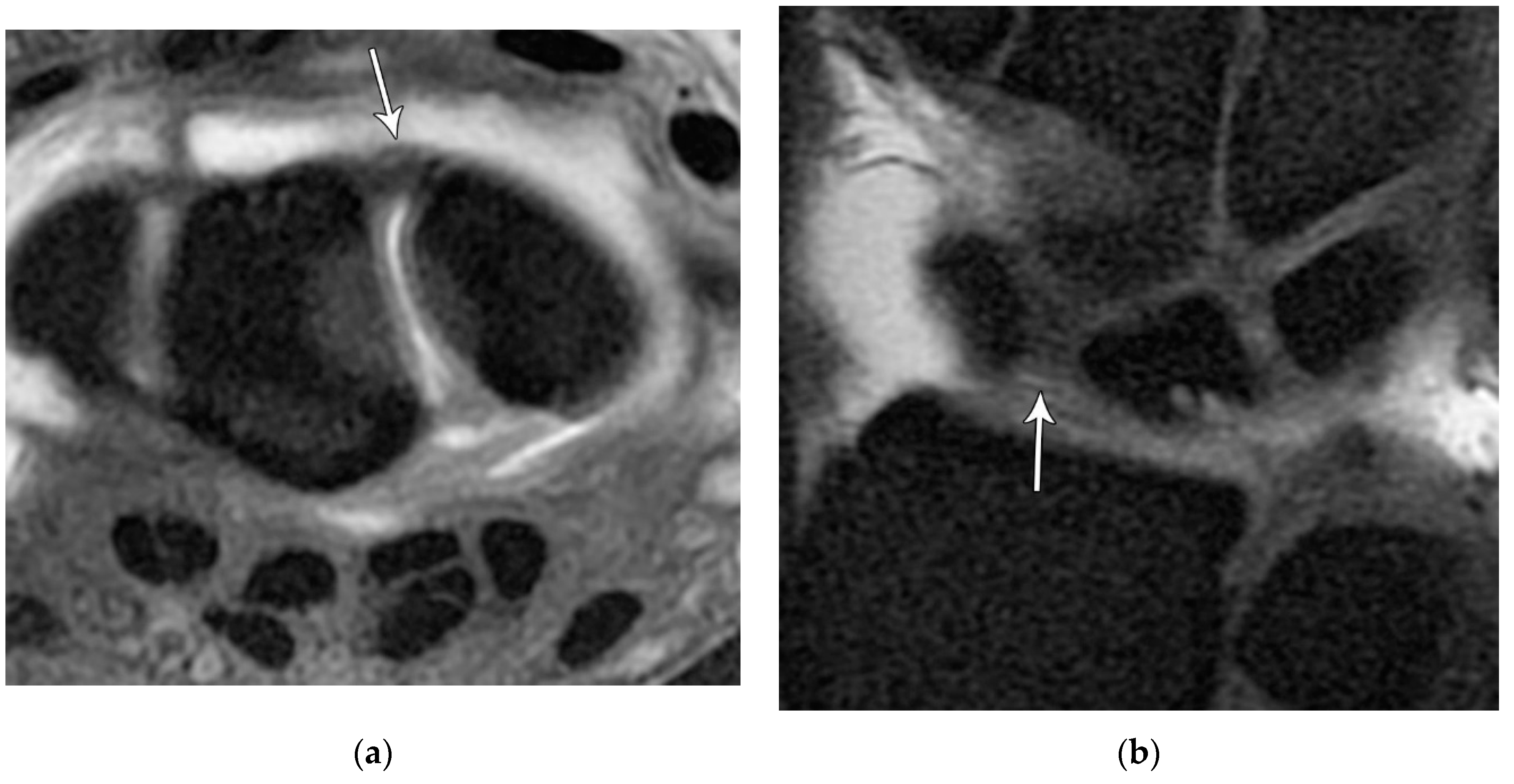 Preprints 72000 g022