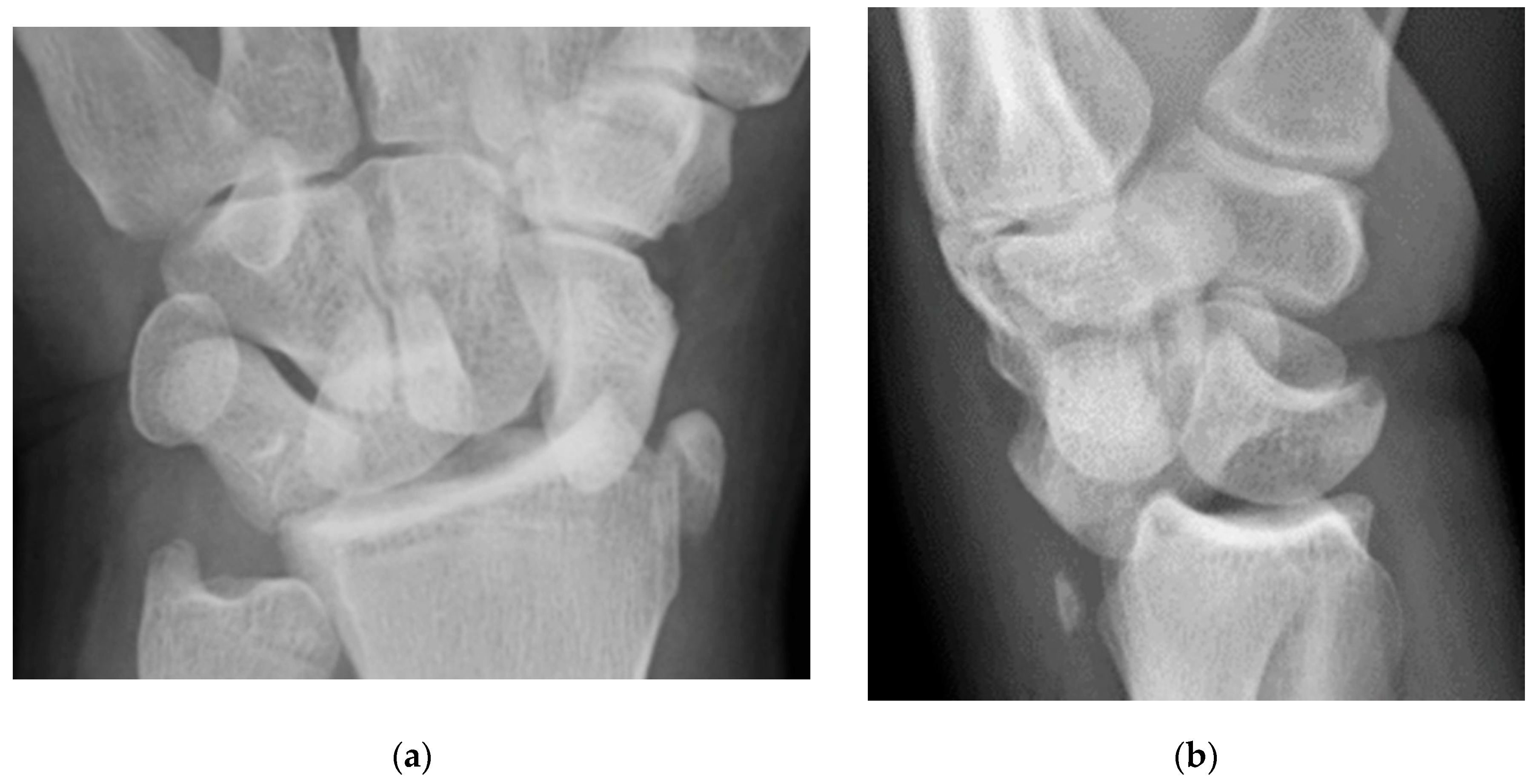 Preprints 72000 g029