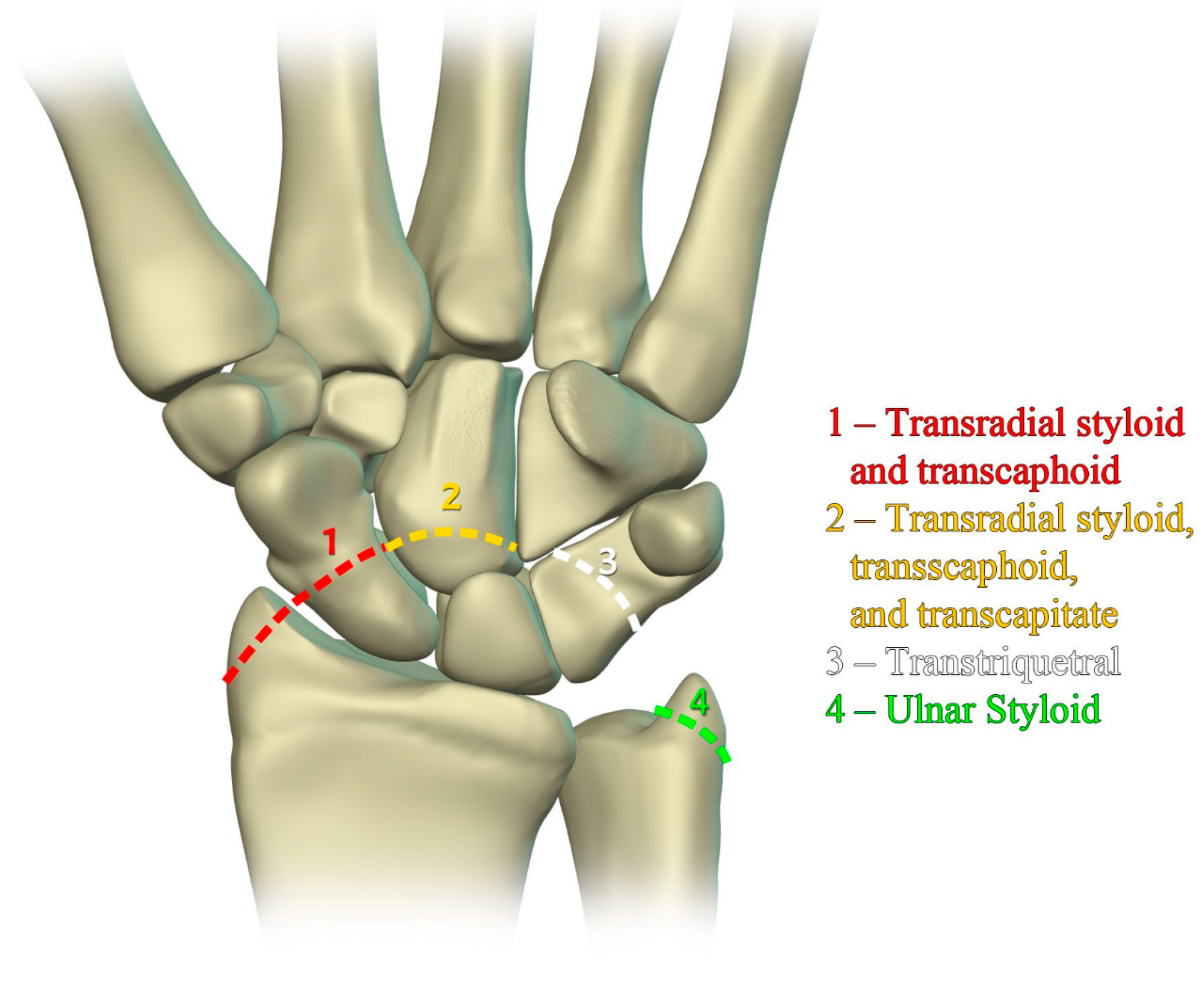 Preprints 72000 g031