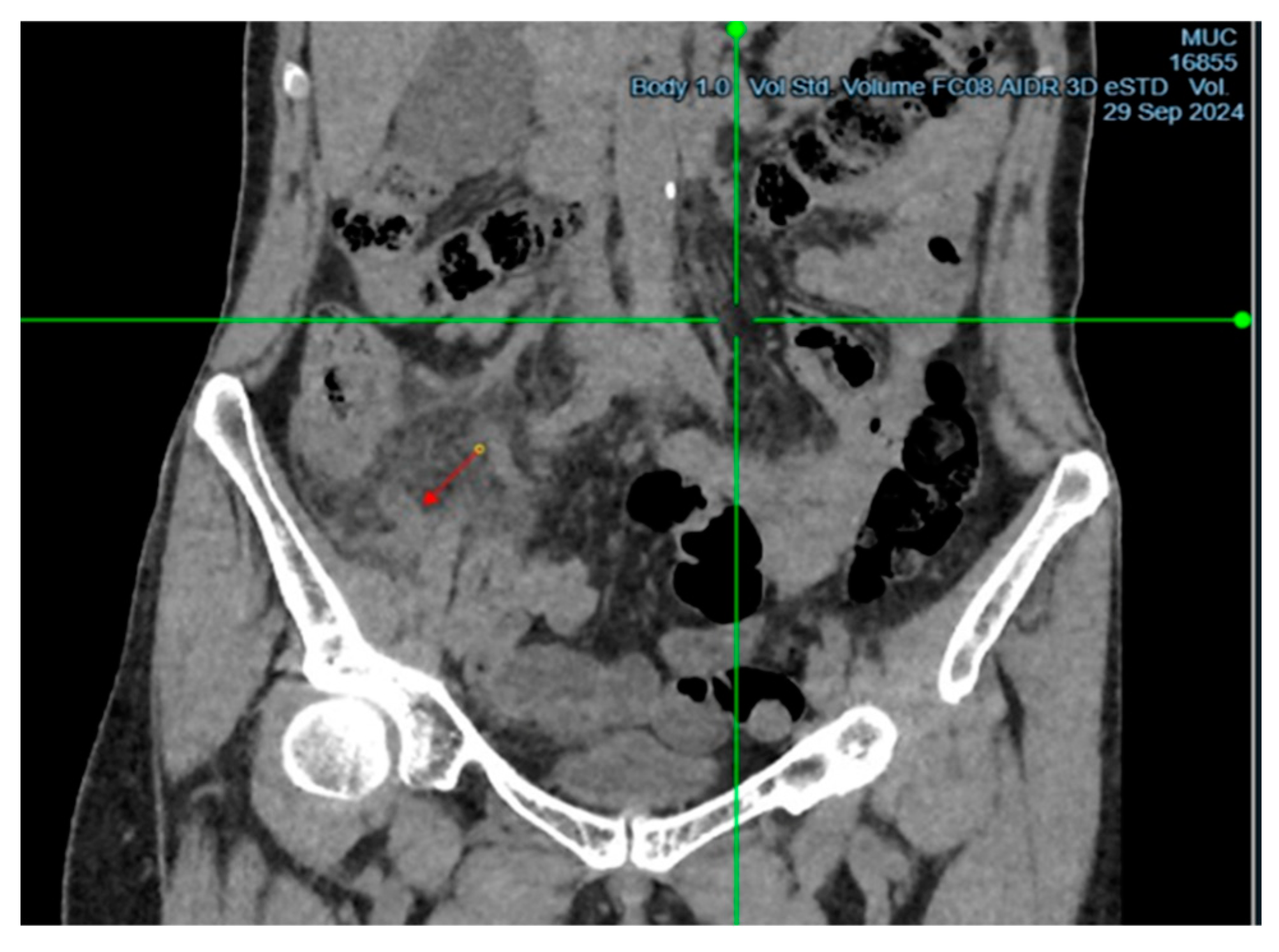 Preprints 156792 g001
