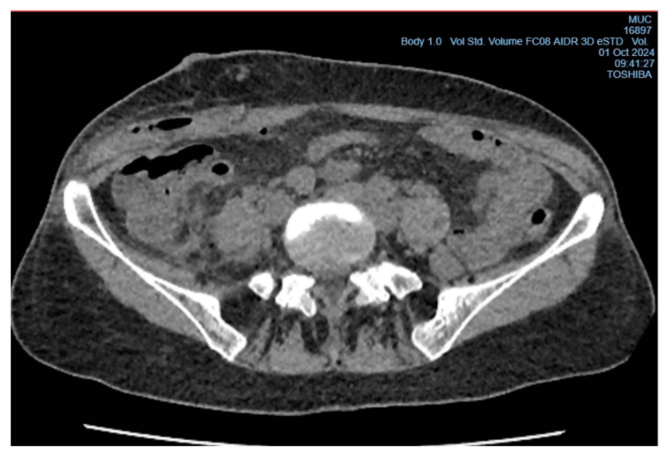 Preprints 156792 g003