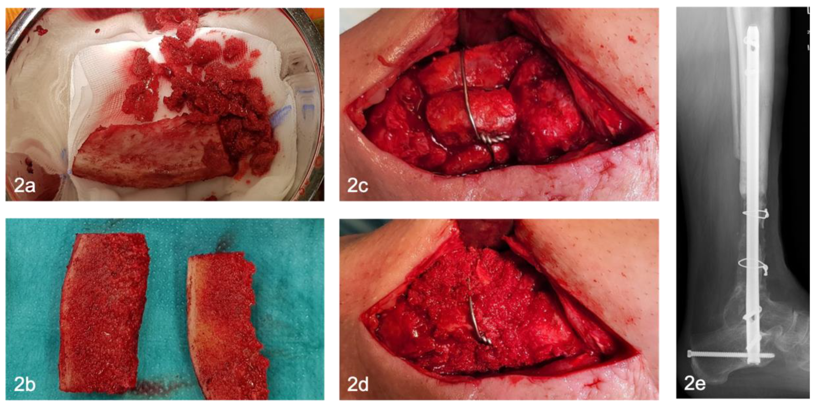 Preprints 165422 g002