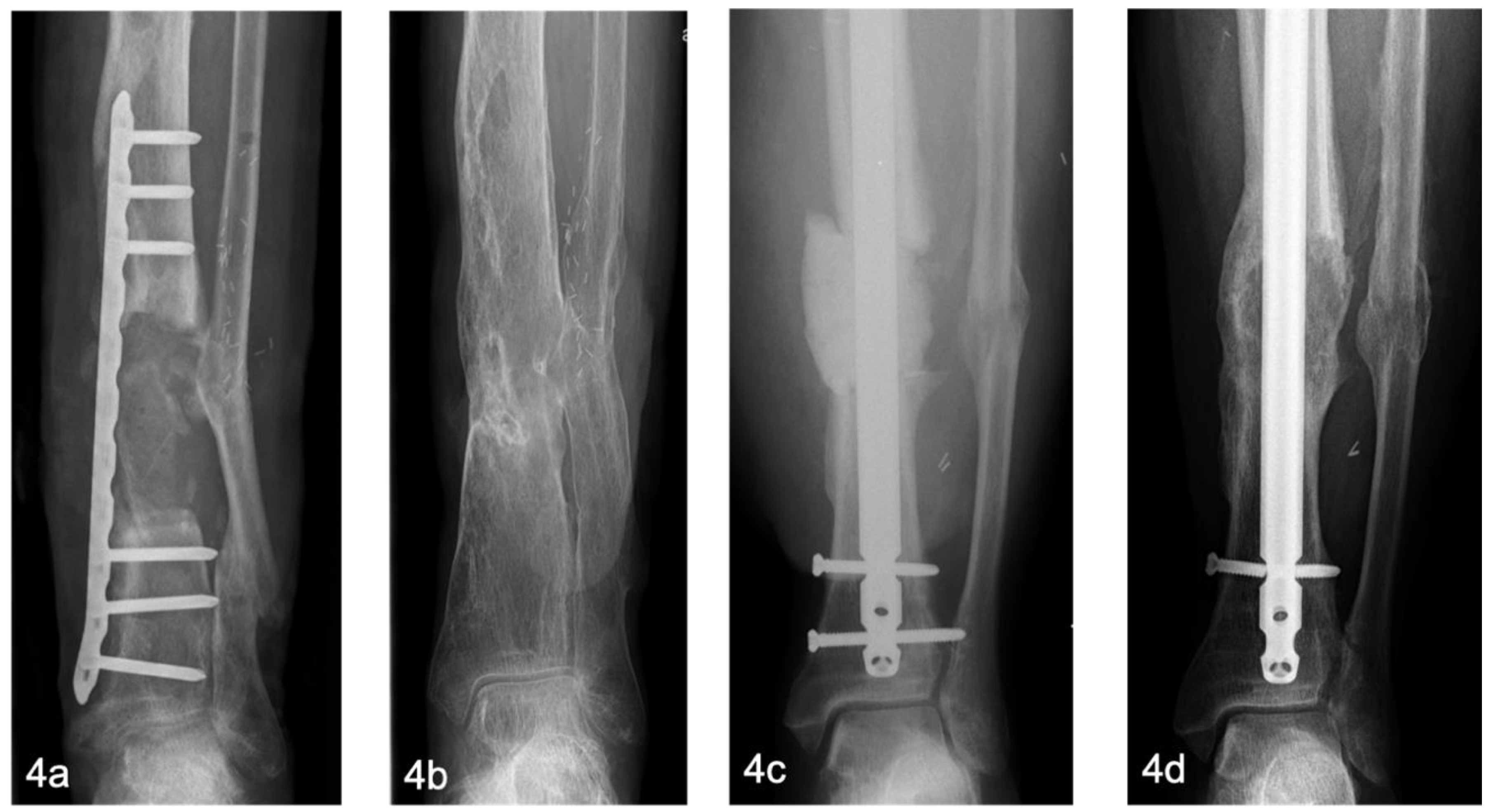 Preprints 165422 g004