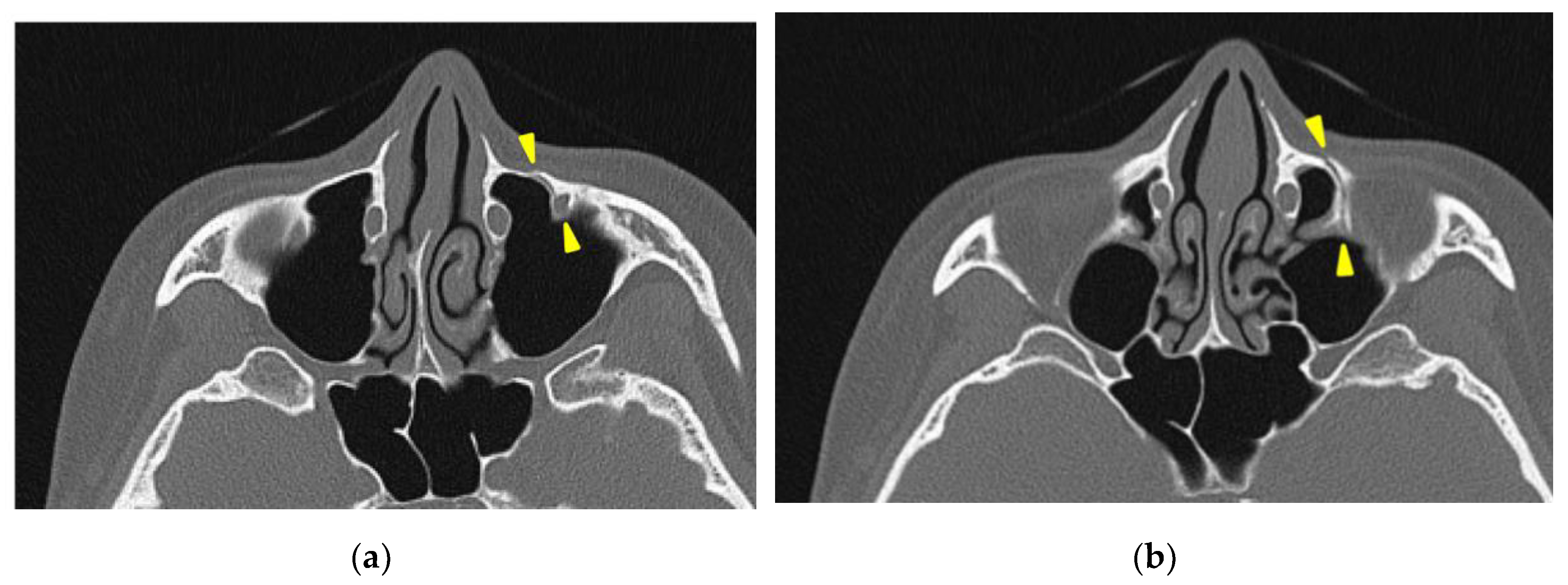 Preprints 149648 g005