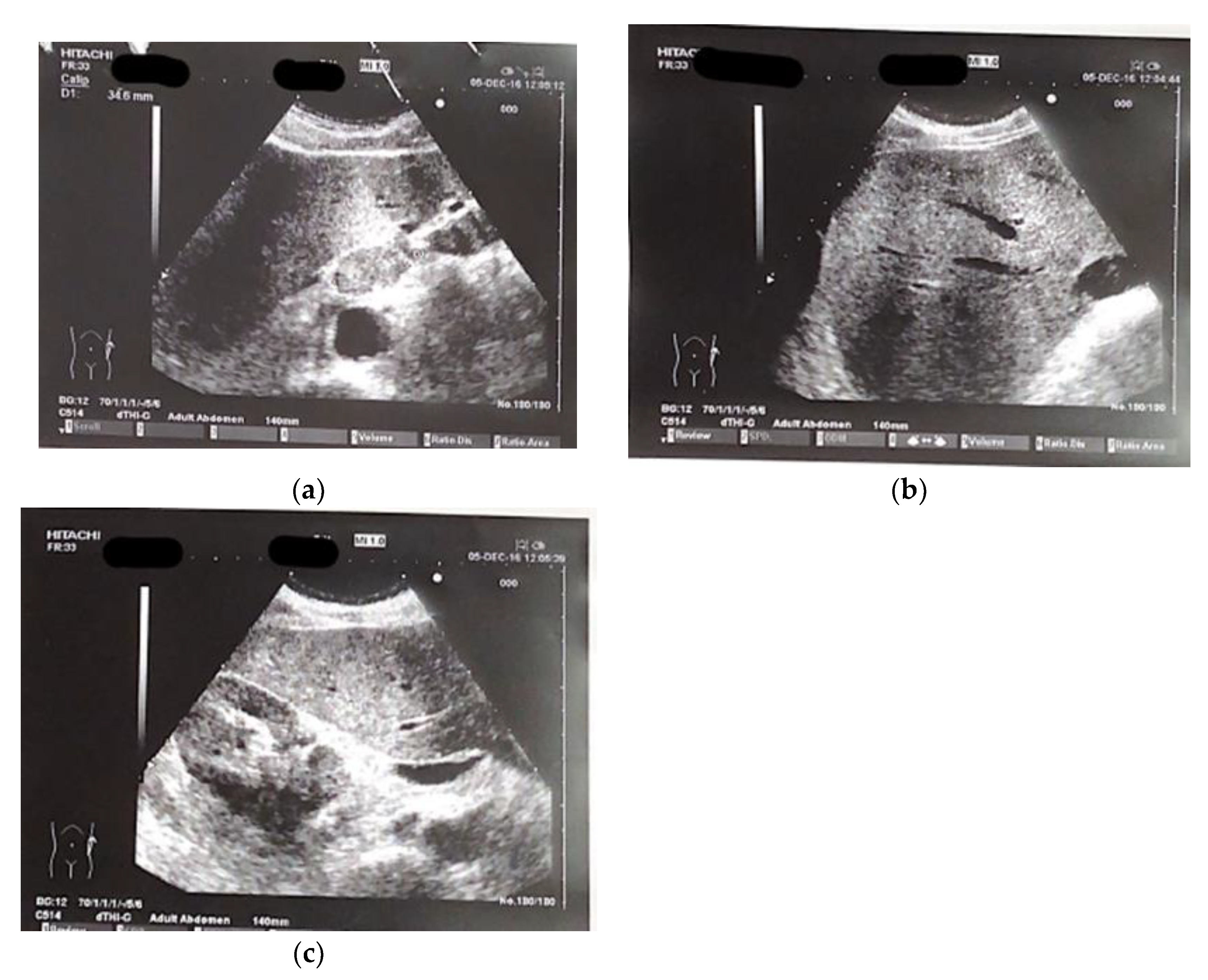 Preprints 79093 g001