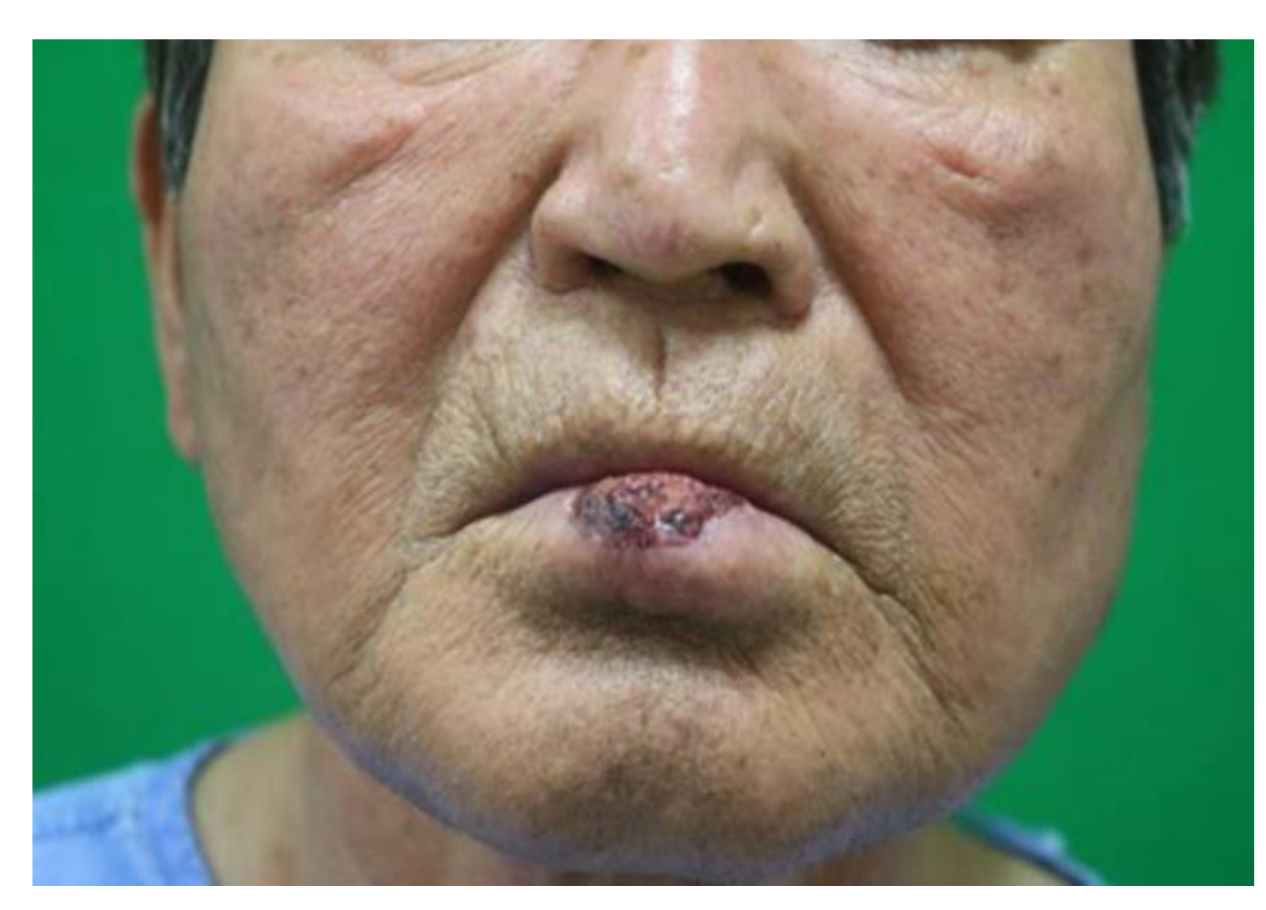 Preprints 184284 g002