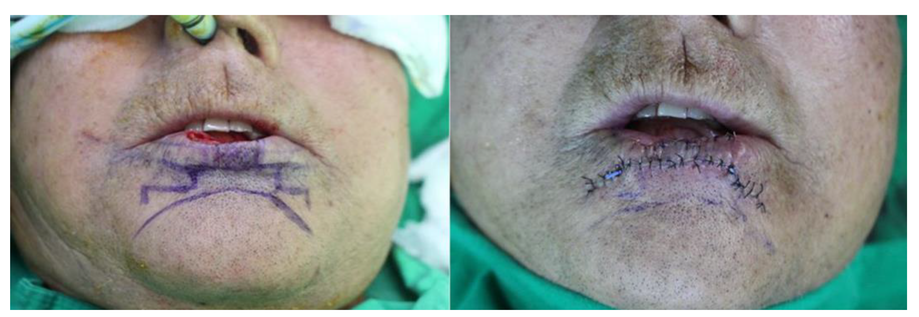 Preprints 184284 g003