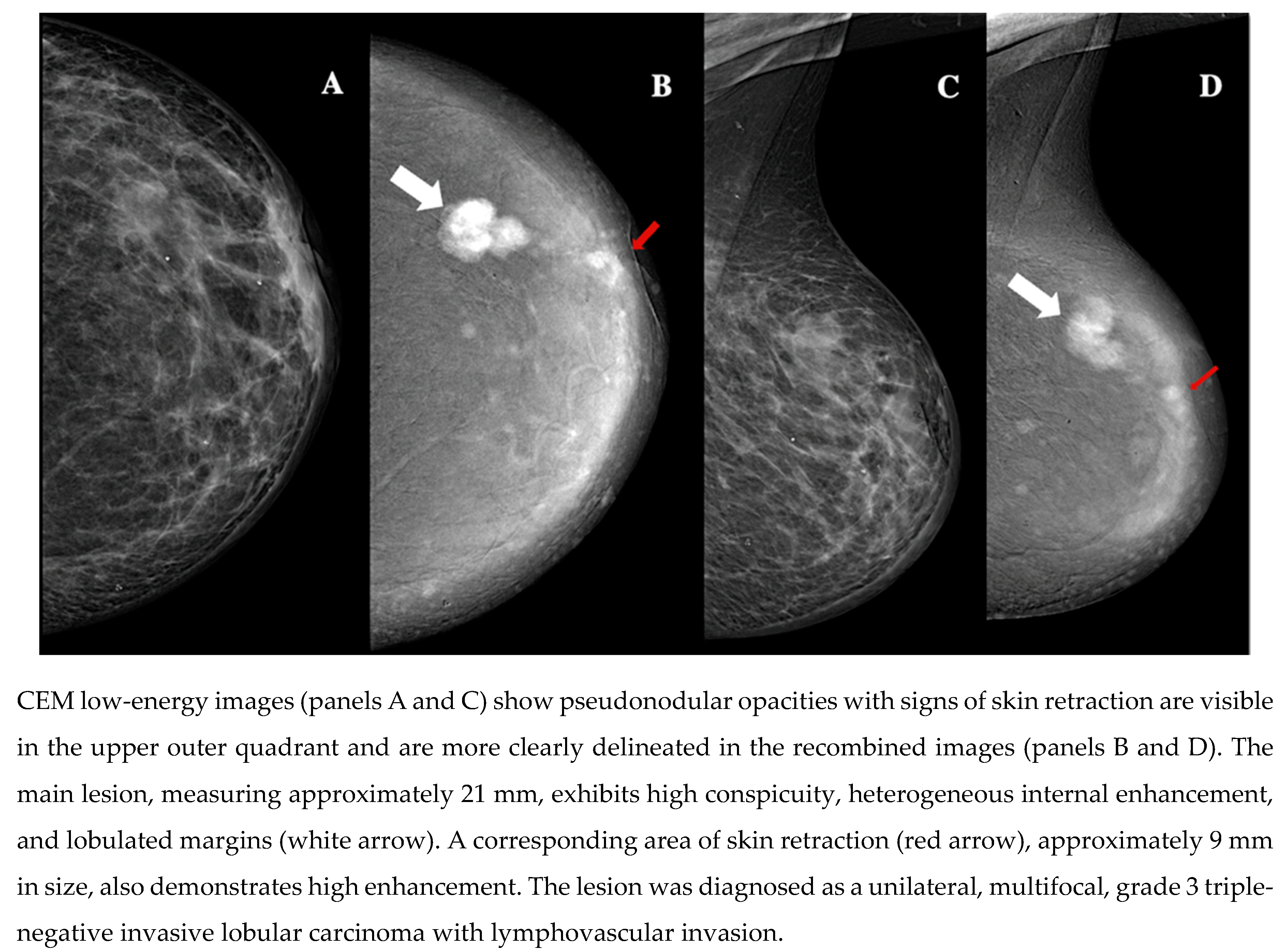 Preprints 151294 g005