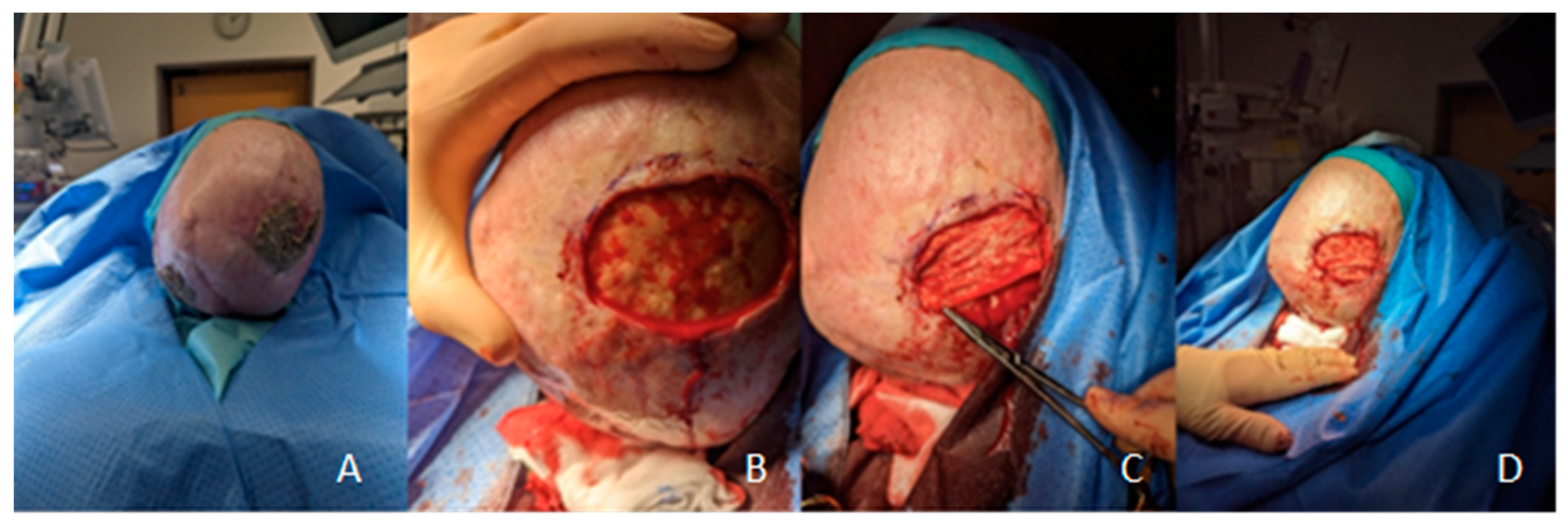 Preprints 139846 g002